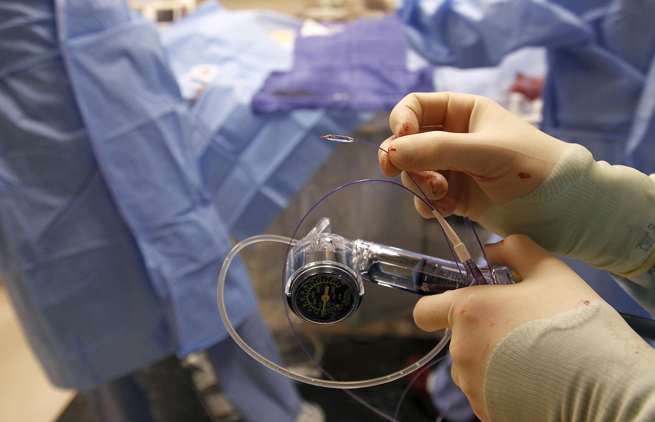 Dr. Tim Henry used a bubble at the tip of this device to insert stem cells into heart attack patient John Hubin at Abbott Northwestern Hospital, Monday, April 22, 2013. (ELIZABETH FLORES/STAR TRIBUNE) ELIZABETH FLORES • eflores@startribune.com