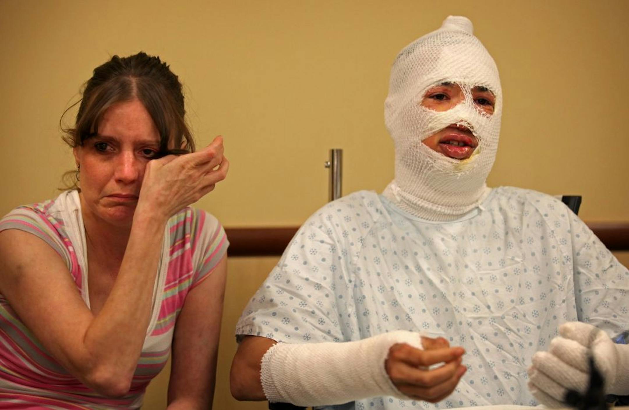 In this file photo from July 22, 2011, Jodi Stewart wiped tears away as her son Antoine Willis spoke to the media from Regions Hospital in St. Paul. Willis suffered second and third degree burns when his mother's boyfriend, Curtis Reed, set him on fire while he was trying to protect his mother from Reed.