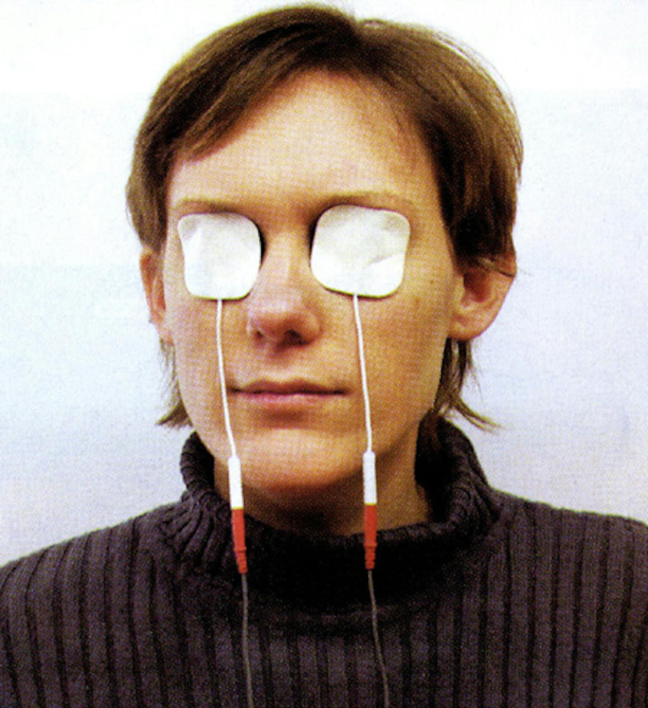 ScyFix President Darrell DeMello calls it "the pacemaker for the eye."