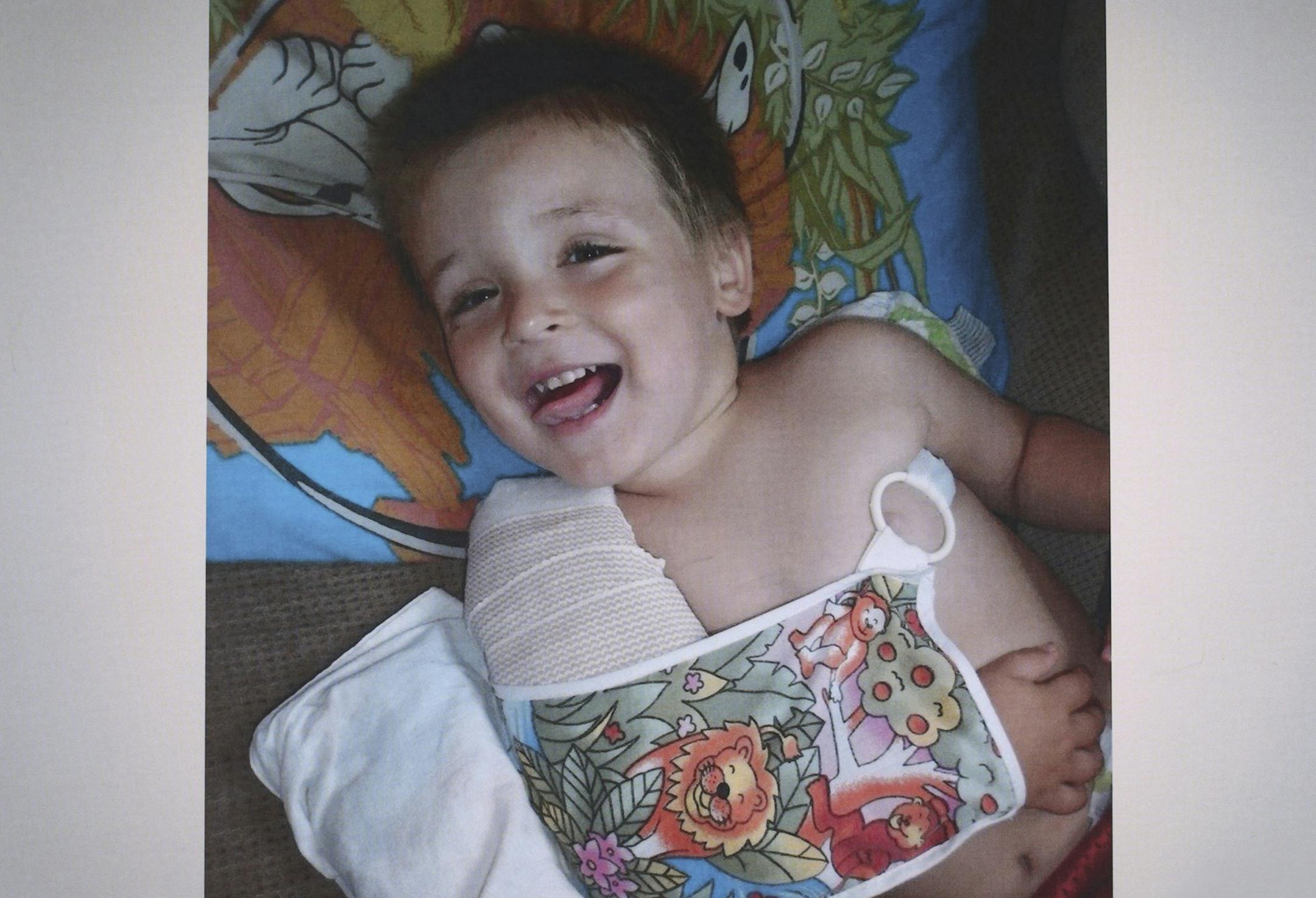 A photograph of Eric Dean with his arm broken was an exhibit presented as evidence by the prosecution during the May 2014 trial of Amanda Peltier in the death of her stepson, Eric Dean. ] JEFF WHEELER ¬• jeff.wheeler@startribune.com Evidence in the murder trial of Amanda Peltier photographed in the Pope County Courthouse in Glenwood on Tuesday, July 15, 2014. The description for the exhibit reads, "Photograph. Pope County Human Services investigation on 7/20/11. Eric Dean fractured r