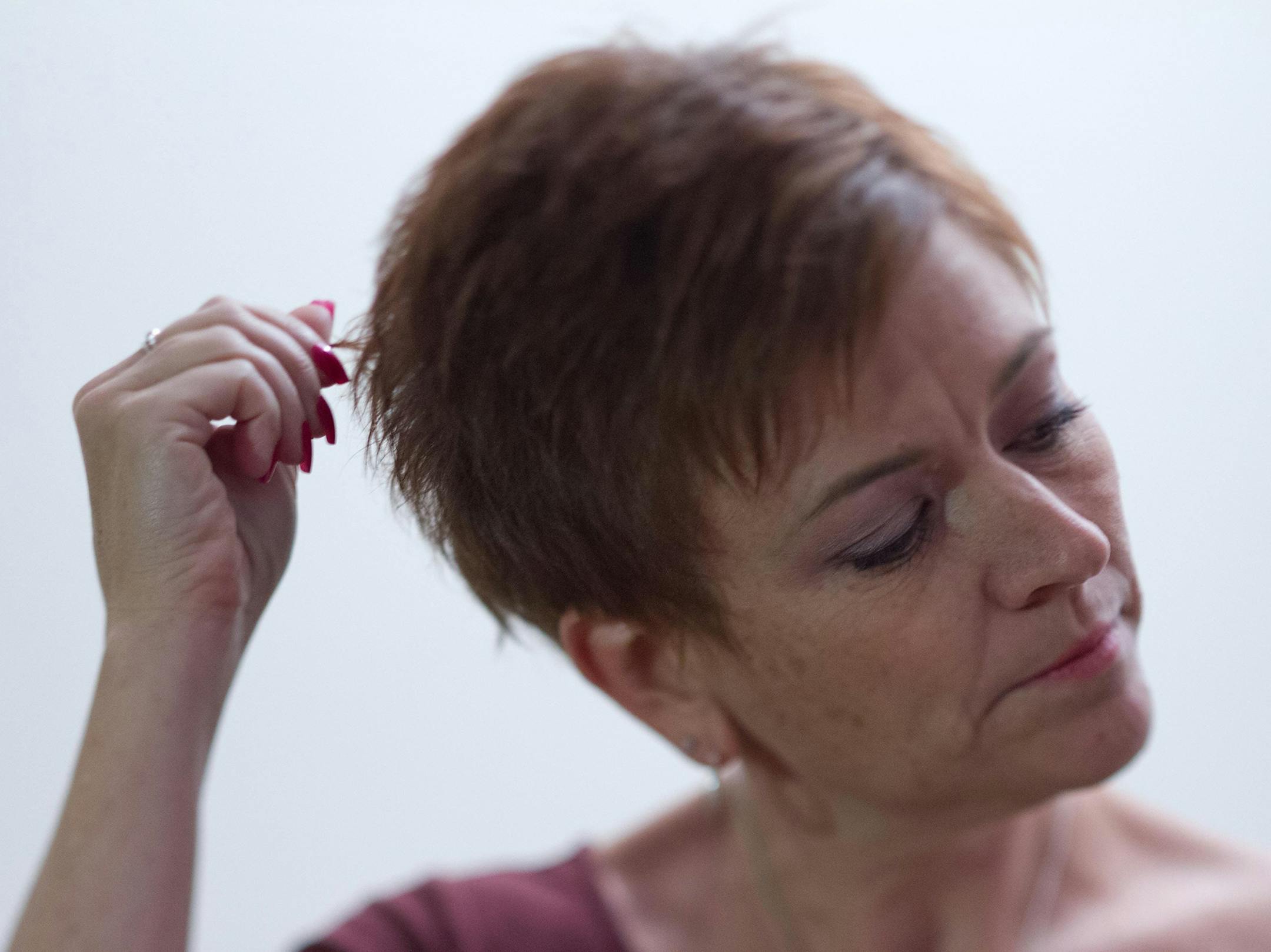 Laurie Piotrowski has tried all sorts of remedies for trichotillomania.