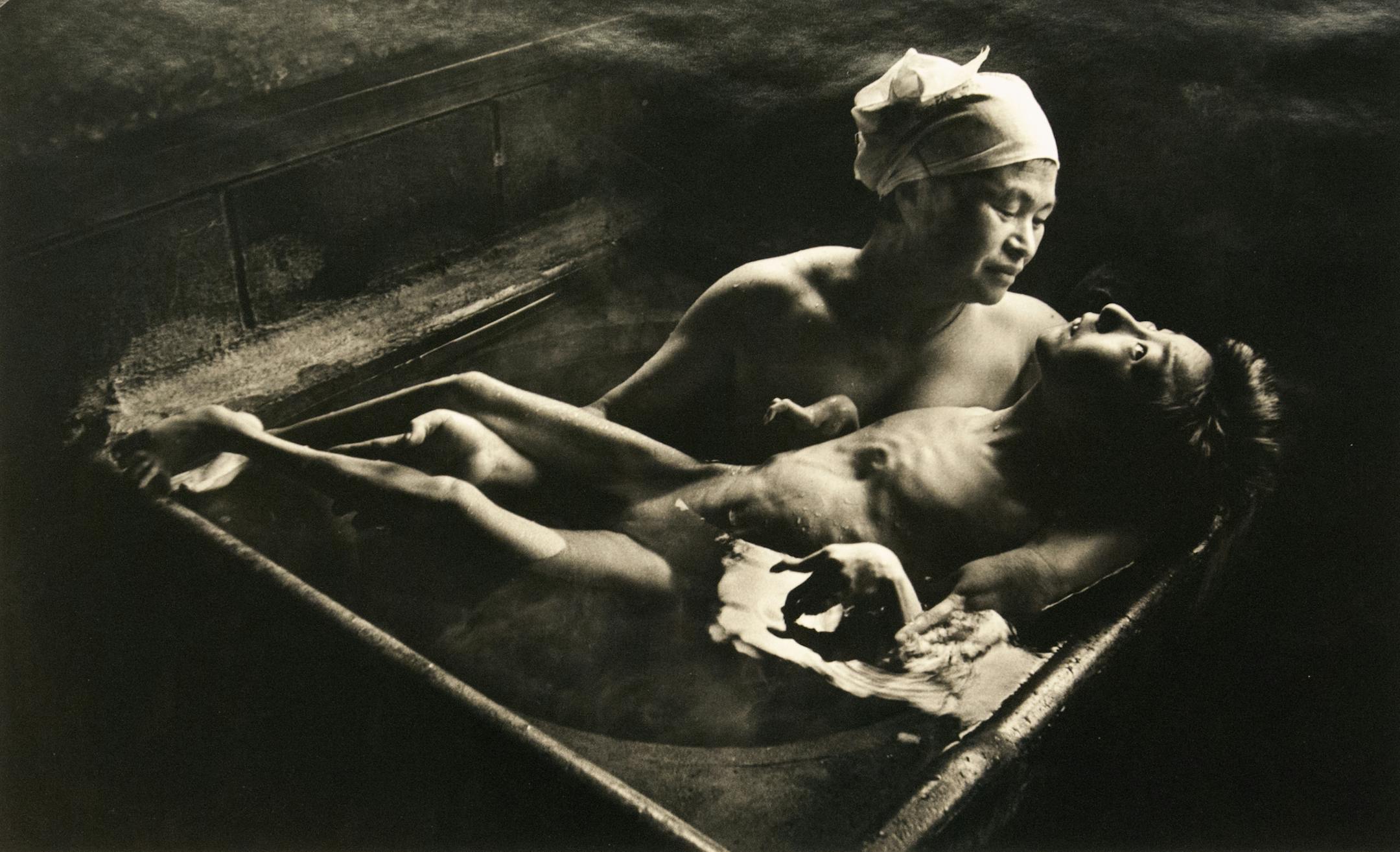 Provided by Weinstein Gallery Photo by W. Eugene Smith. Published in 1972, ‚ÄúTomoko Uemura in her bath‚Äù records a Japanese woman tenderly bathing her 15 year old daughter whose tragic birth deformities were caused by mercury pollution from industrial chemicals
