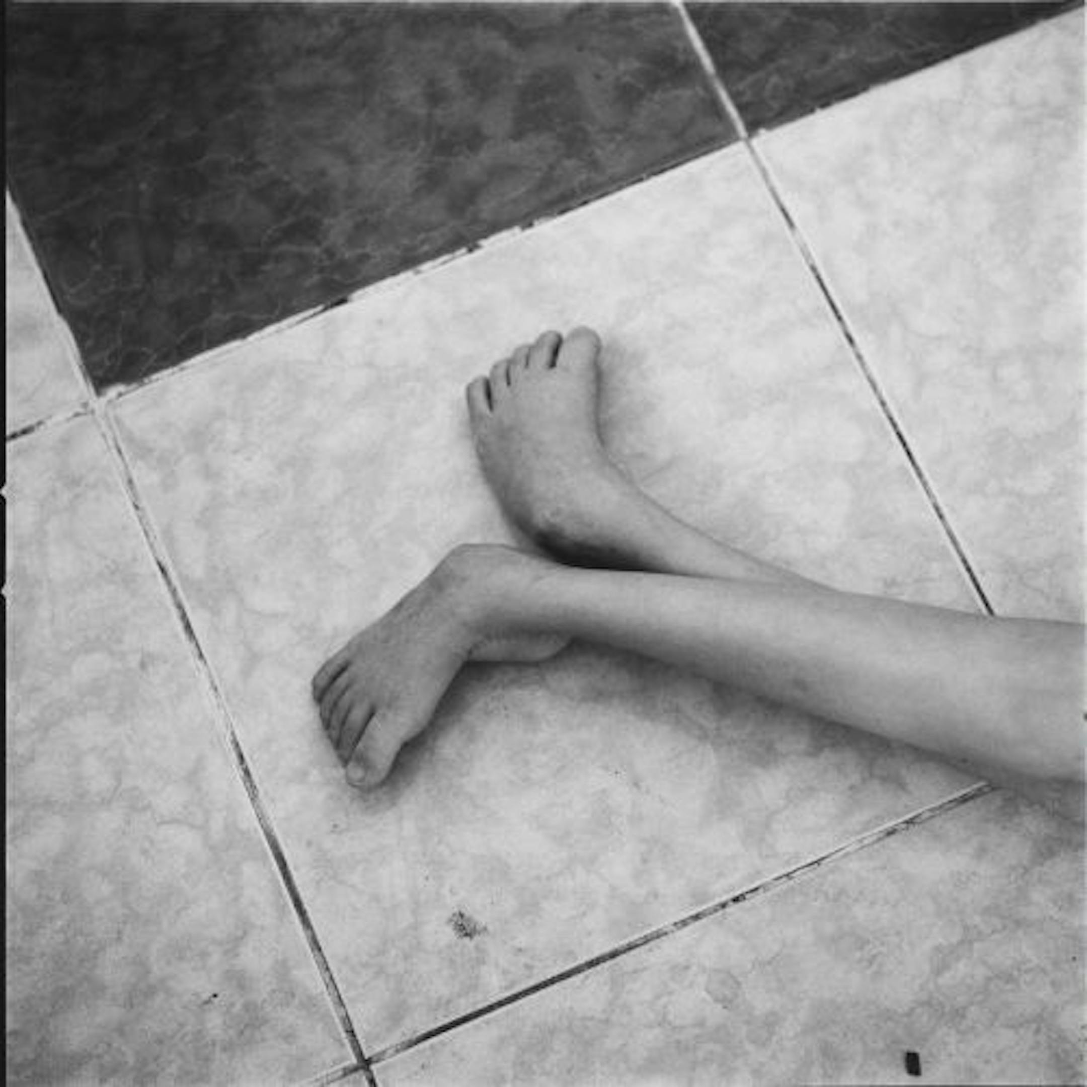 St. Paul photographer Petronella Ytsma bears witness to the lingering tragedies of the Vietnam War. Deformed feet are typical.