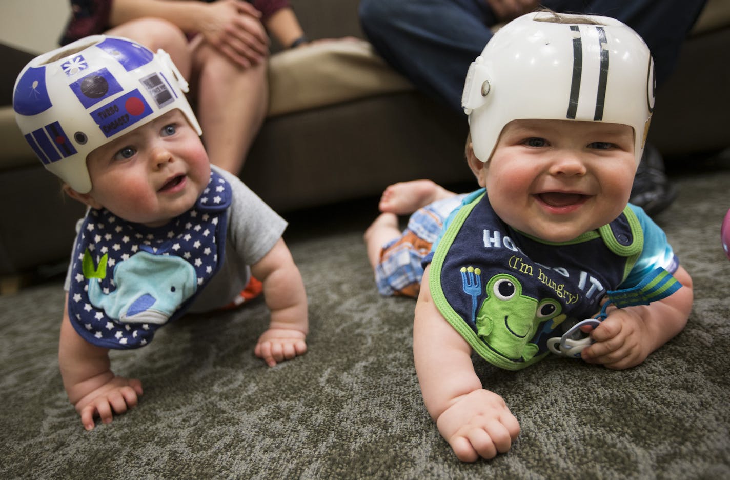 Nolan and Lincoln Potts sported their custom-made CranioCaps at Gillette Children&#x2019;s Specialty Healthcare in St. Paul.