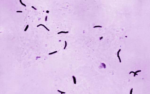 This 1966 microscope photo provided by the U.S. Centers for Disease Control and Prevention shows Mycobacterium tuberculosis bacilli, the organism resp