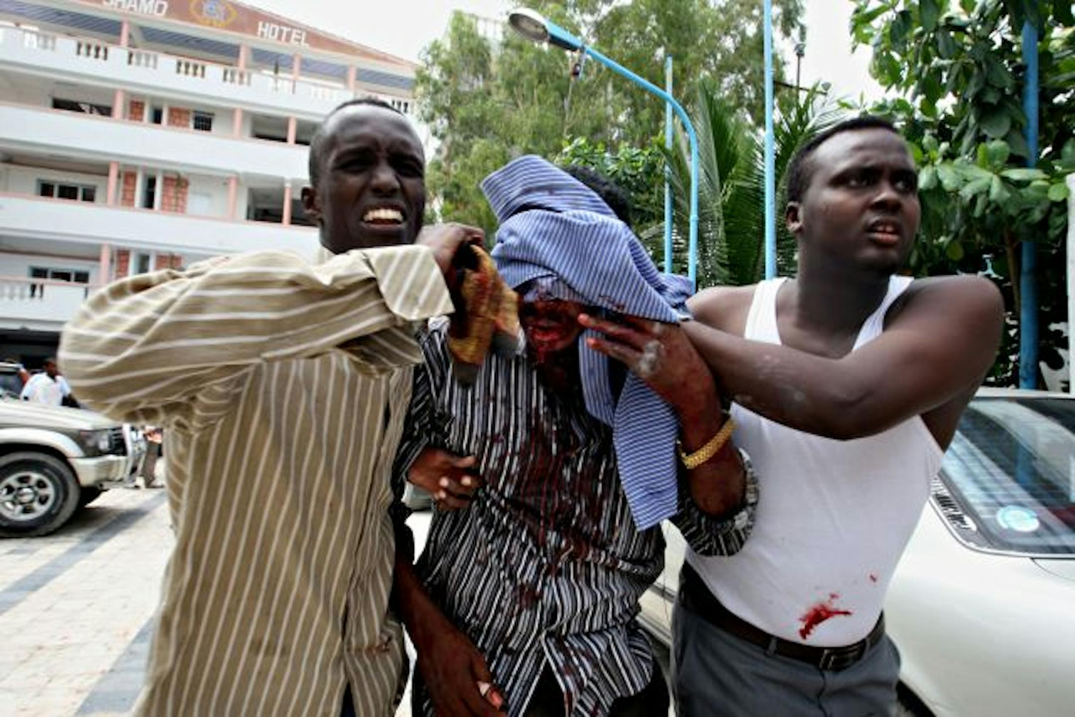 A Somali mab who was injured in a suicide bomb attack during a university student graduation ceremony at a local hotel in Mogadishu, Somalia is carried by other graduating students on December 3, 2009. Eighteen people, including three government ministers, were killed in a suicide attack on a graduation ceremony at a Mogadishu hotel, a security official investigating the blast told AFP. AFP PHOTO/Mohamed DAHIR