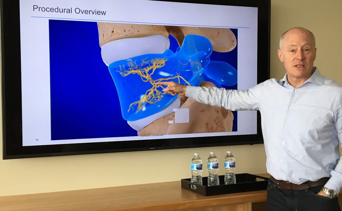 Relievant Medsystems CEO Kevin Hykes demonstrates where radiofrequency energy is applied to sever the basivertebral nerve, in yellow, during the &#x201c;Intracept&#x201d; procedure for certain forms of lower back pain. The company makes equipment and supplies for the procedure, including an electrode-tipped catheter inserted into lower-spine vertebrae to permanently zap the nerve.