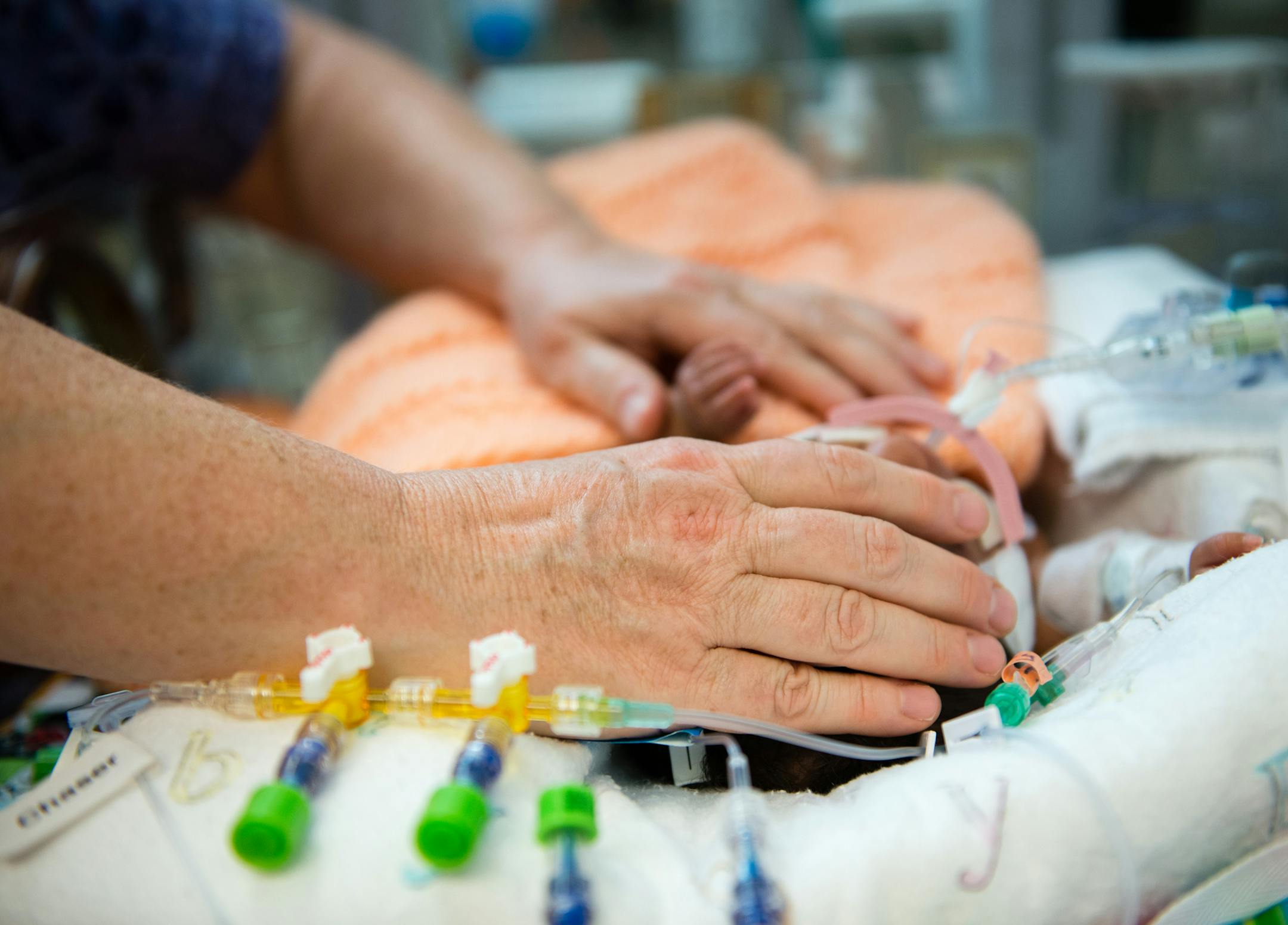 Registered nurse Kate Teague caresses a premature baby's head at the neonatal intensive-care unit at Lucile Packard Children's Hospital in Palo Alto, Calif., on Oct. 20, 2015. (Heidi de Marco/Kaiser Health News/TNS)
