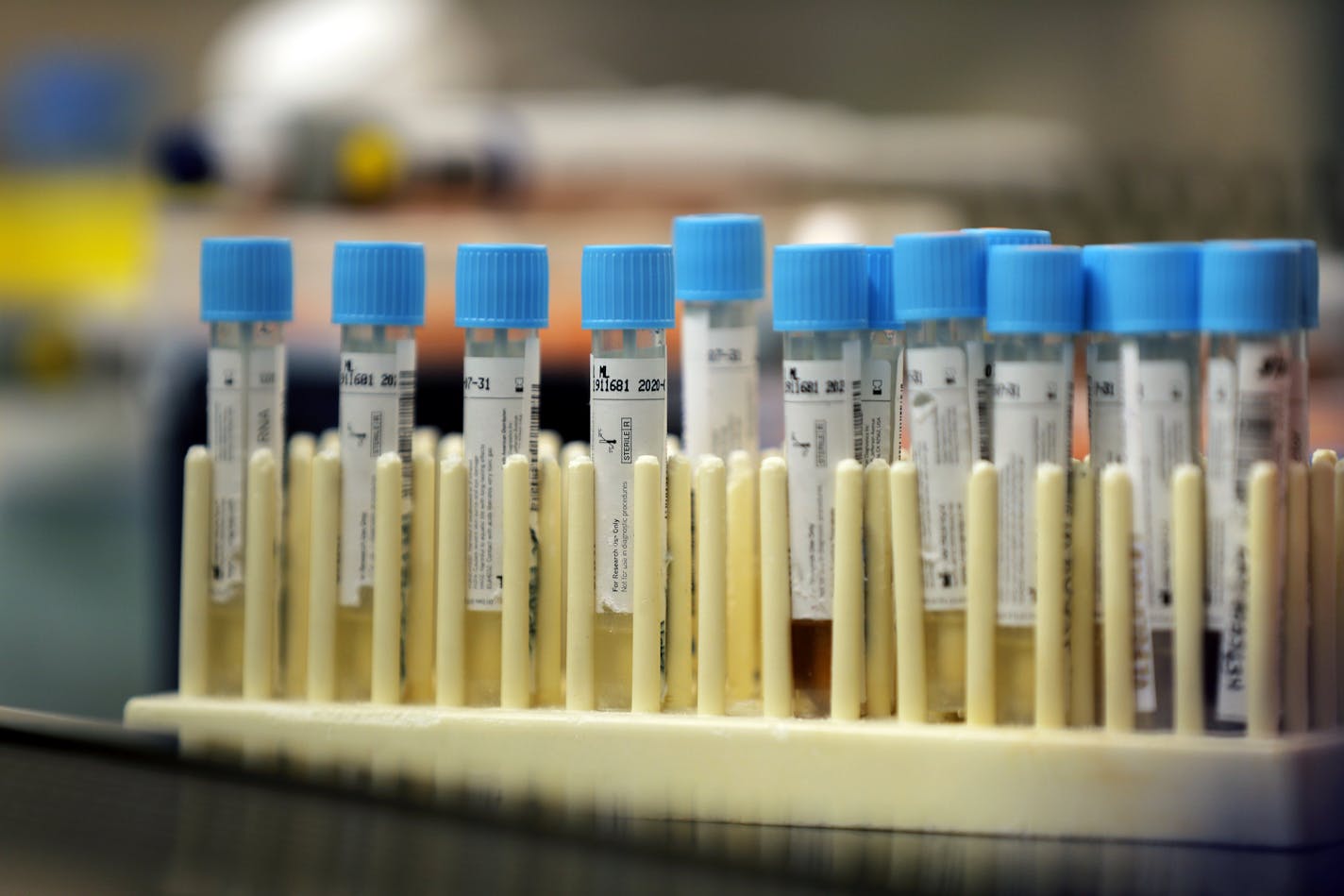 Vials with samples taken for the new coronavirus are seen before they are prepared for RNA testing at the molecular pathology lab at Tulane University School of Medicine in New Orleans, Thursday, April 2, 2020. The test is identical to the PCR test being used by the Centers for Disease Control to ease the testing crisis and stop the spread of COVID-19, which has hit the New Orleans area especially hard. (AP Photo/Gerald Herbert)