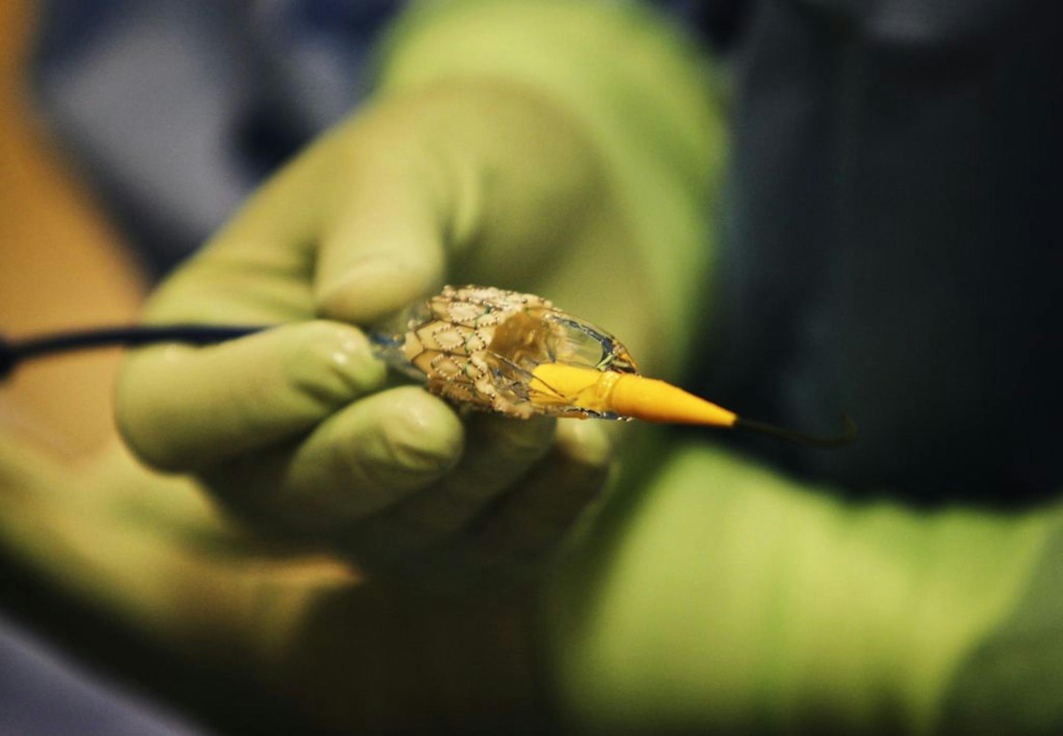 Nurse Jillian Schoenleben held a valve fashioned from a cow's, and partially crimped onto a delivery device used during the aortic valve replacement procedure at Abbott Northwestern Hospital in Minneapolis MN, Tuesday, May 15, 2012. Schoenleben's job in the procedure was to crimp the valve on the delivery device.