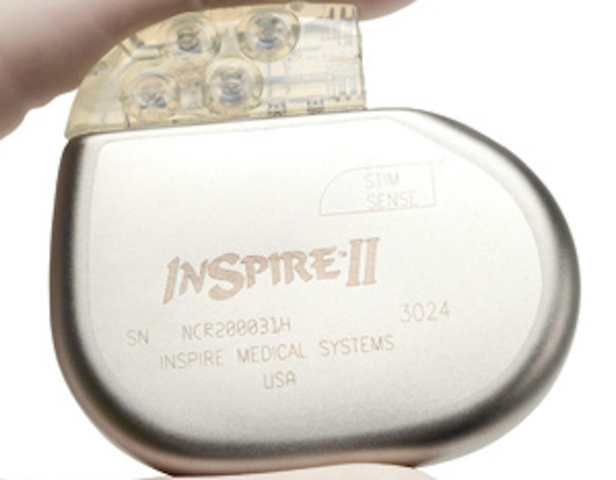 Inspire Medical Systems' pacemaker-like device sends electric pulses to nerves in the tongue to control sleep apnea.