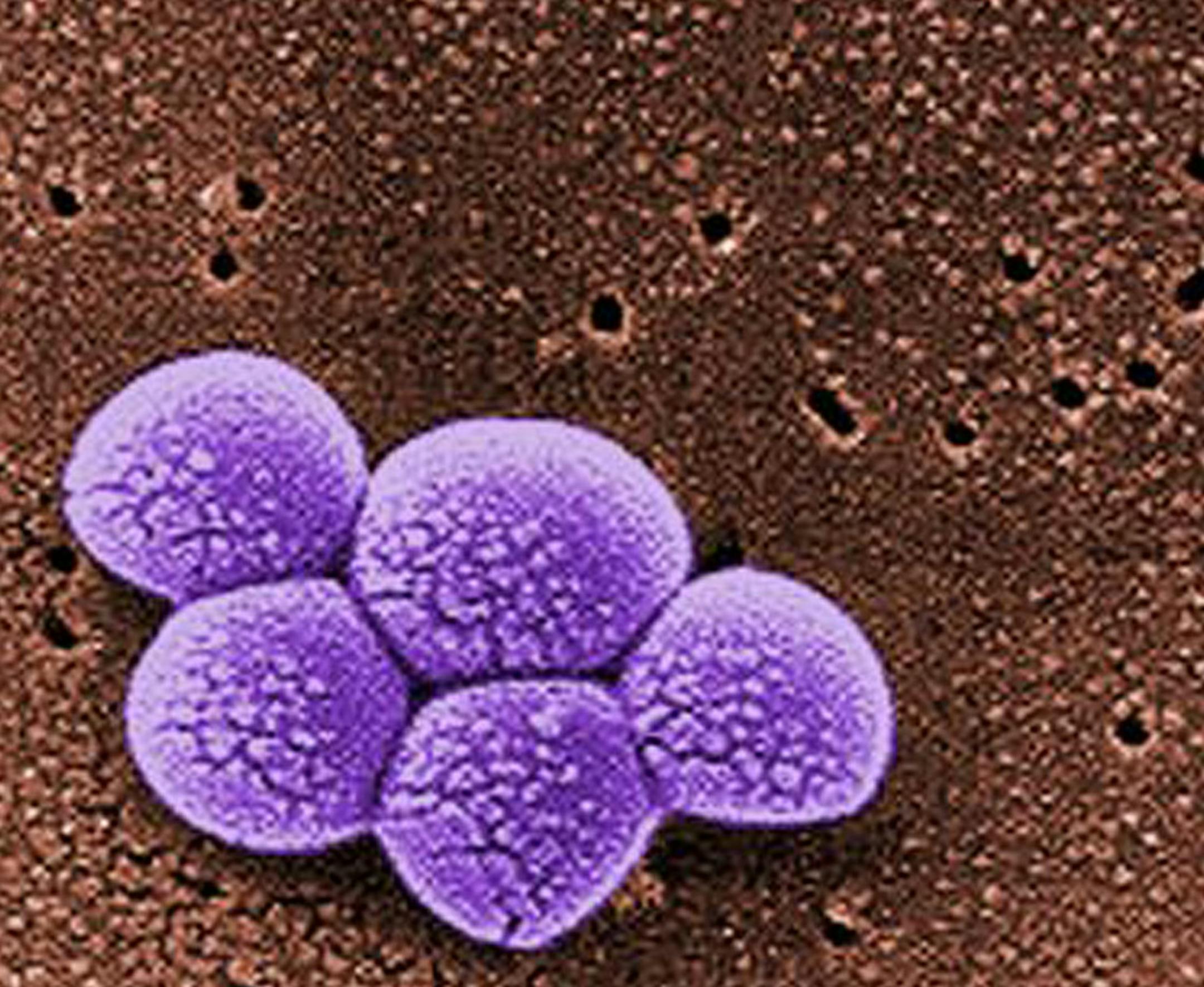 COURTESY JANICE CARR/CDC. Magnified 20,000X, this colorized scanning electron micrograph (SEM) depicts a grouping of methicillin resistant Staphylococcus aureus (MRSA) bacteria.