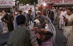 A person wounded in a bomb blast outside the Kabul airport in Afghanistan on Thursday arrives at a hospital in Kabul. The Pentagon confirmed two blast