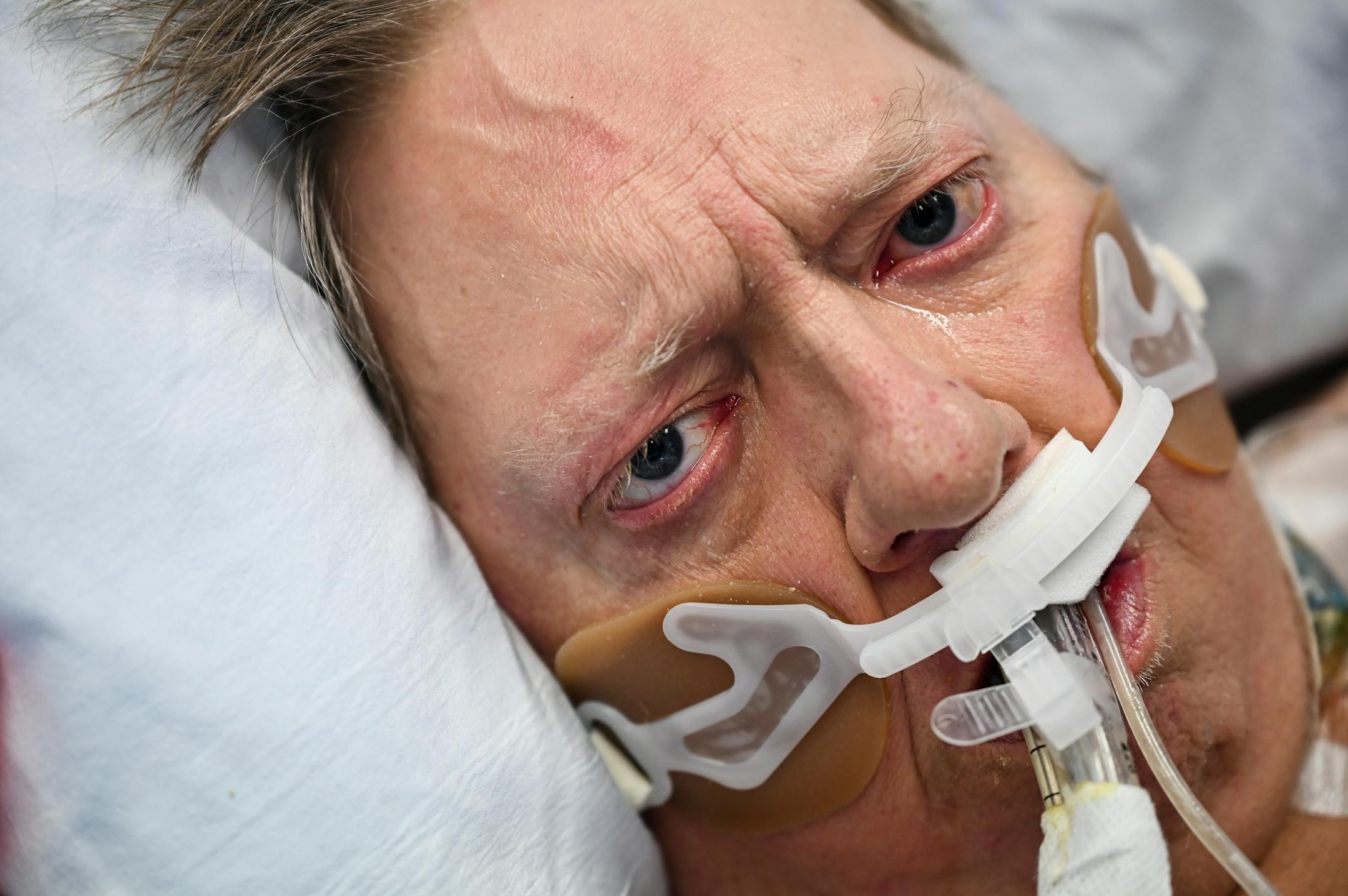 "No fun," Dennis Denzer, 59, wrote on a piece of paper before tears ran down his face as he was in the South Seven Intensive Care Unit Tuesday afternoon. He just tested positive for COVID-19, but was fighting another serious illness.