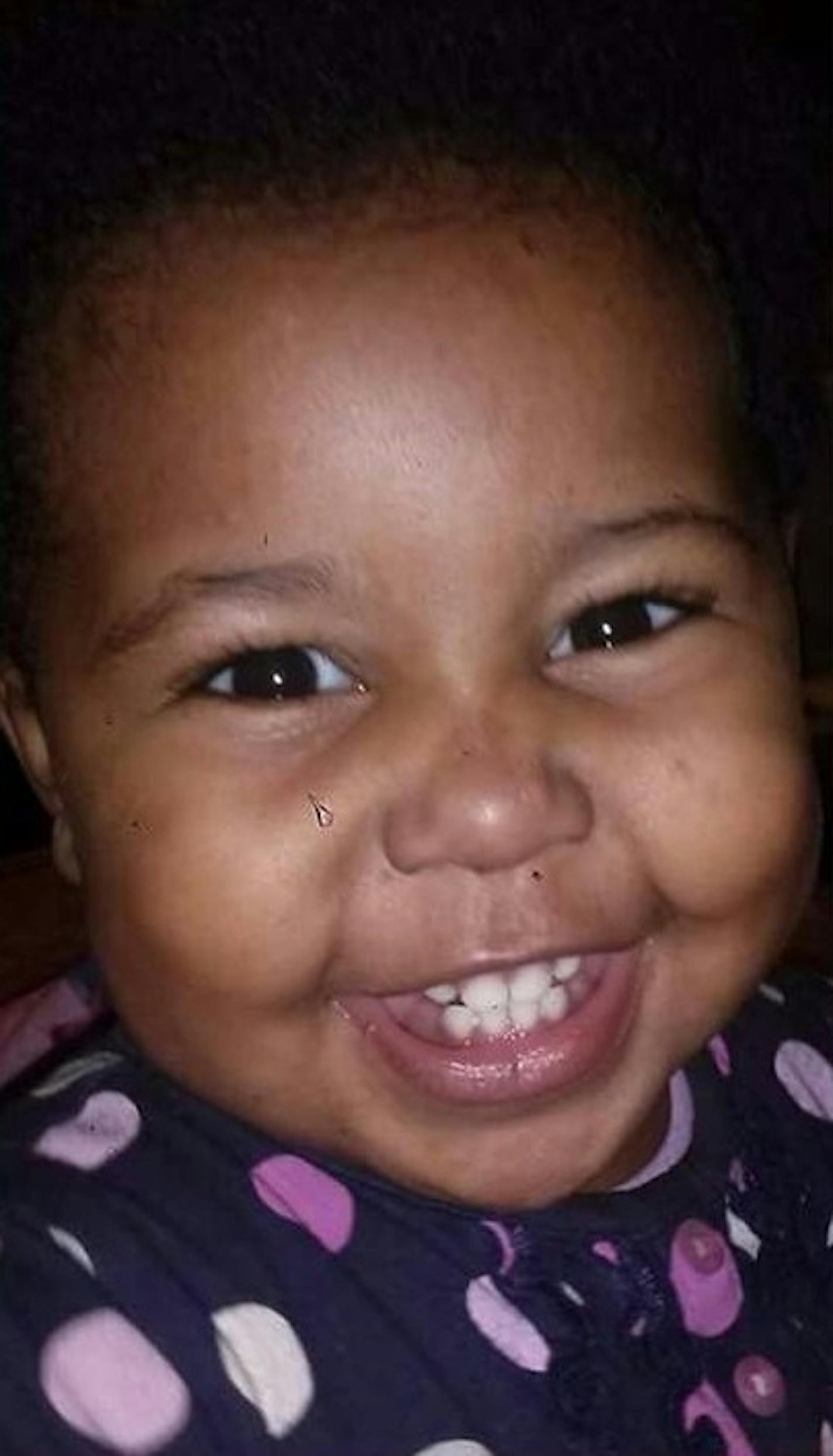 Rae'Anna Hall, who is 20 months old, suffered severe head injuries, numerous broken bones and other wounds in the family's home.