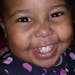 Rae'Anna Hall, who is 20 months old, suffered severe head injuries, numerous broken bones and other wounds in the family's home.