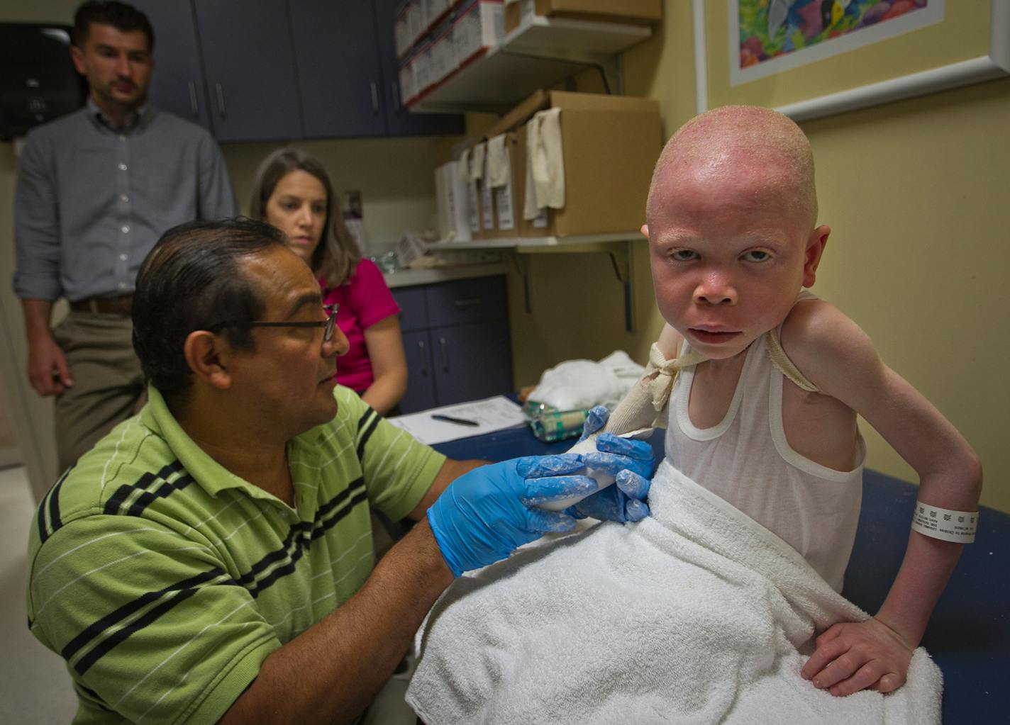 Luis F. Velasquez, Certified Prosthetics, creates a mould for a prosthetic for Baraka Cosmas Rusambo, 6, of Tanzania at Global Medical Relief Fund and Shriners Hospital for Children in Philadelphia on Wednesday, June 17, 2015. In March, assailants lopped off the right hand of Rusambo. Tanzanians subscribing to superstition see those with albino complexions as demons or ghosts with mystical powers whose body parts are cut off and used in witchcraft and potions. (Alejandro A. Alvarez/Philadelphia