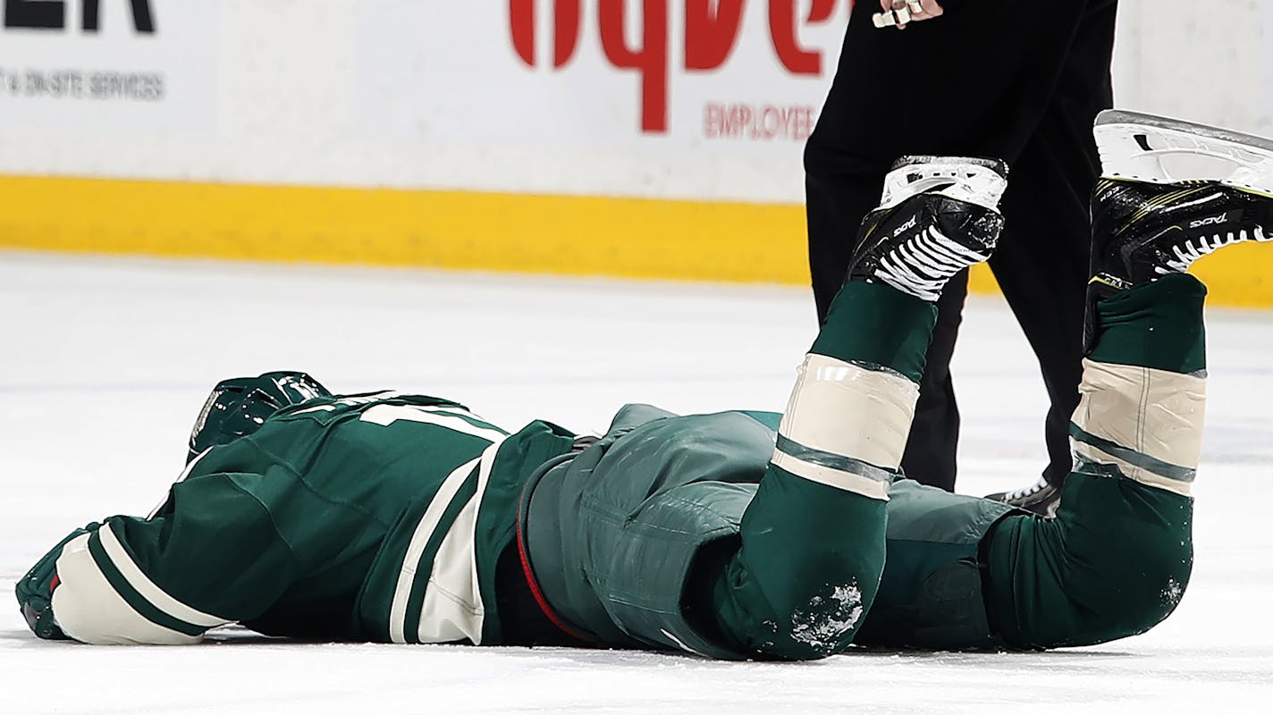 Zach Parise (11) was hit in the face with a high stick by Tom Wilson in the first period. ] CARLOS GONZALEZ &#xef; cgonzalez@startribune.com - March 28, 2017, St. Paul, MN, Xcel Energy Center, NHL, Hockey, Minnesota Wild vs. Washington Capitals