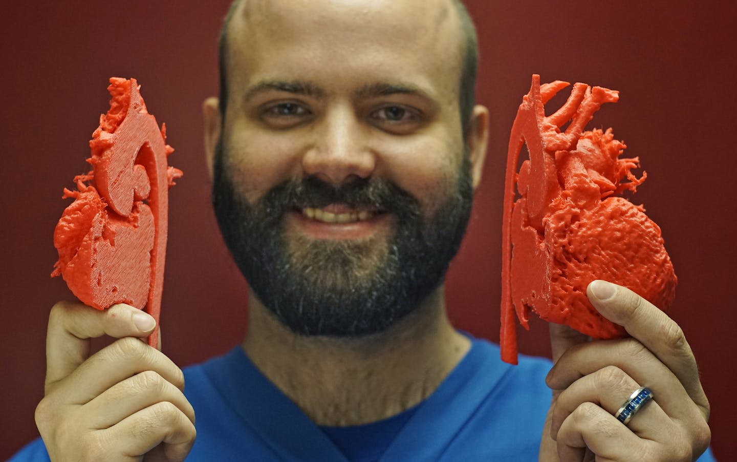 At the Visible Heart Research laboratory on the U of M campus, Ph.D. candidate Brian Howard shows a 3D model of the blood flow of a 10-year old's heart which has been implanted with a stent.] Richard Tsong-Taatarii/rtsong-taatarii@startribune.com