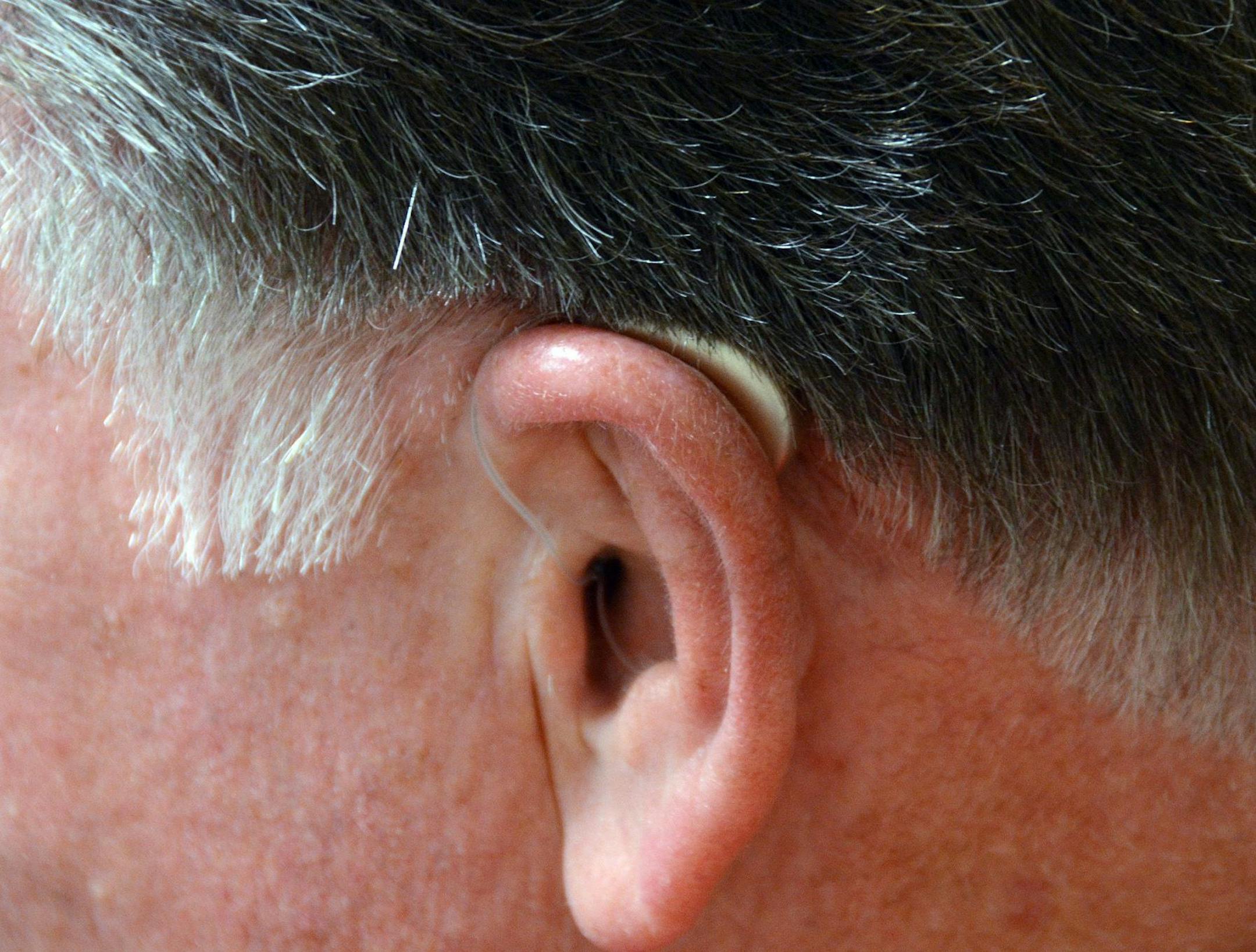 David Brahee wearing the Starkey Halo i110.