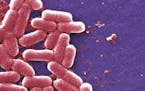 The CDC tested more than 5,770 samples of bacteria and found 221 had genes that conferred resistance.