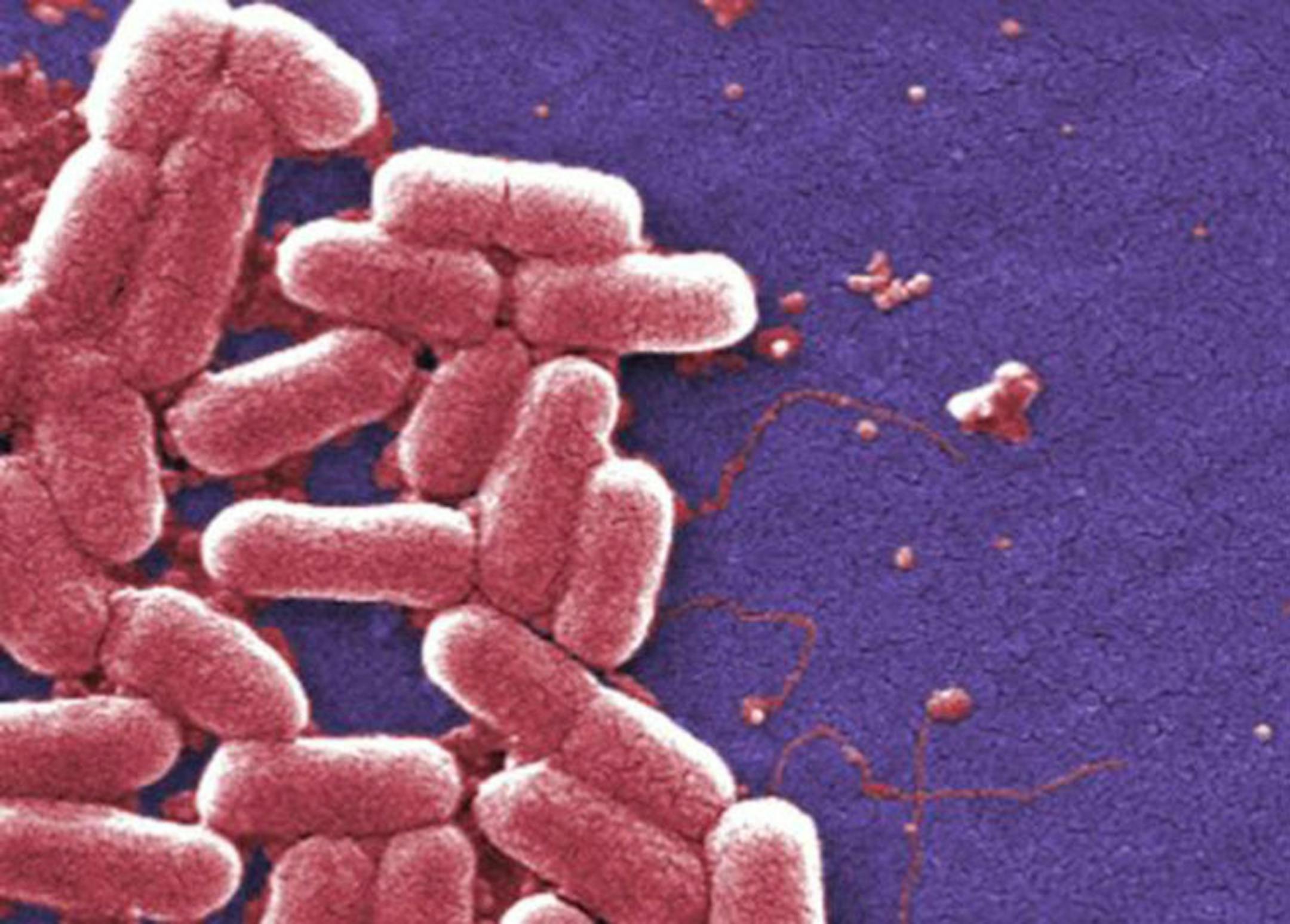 The CDC tested more than 5,770 samples of bacteria and found 221 had genes that conferred resistance.