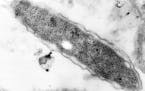 This is a magnified image of the legionnaires bacterium made from an electron microscope.