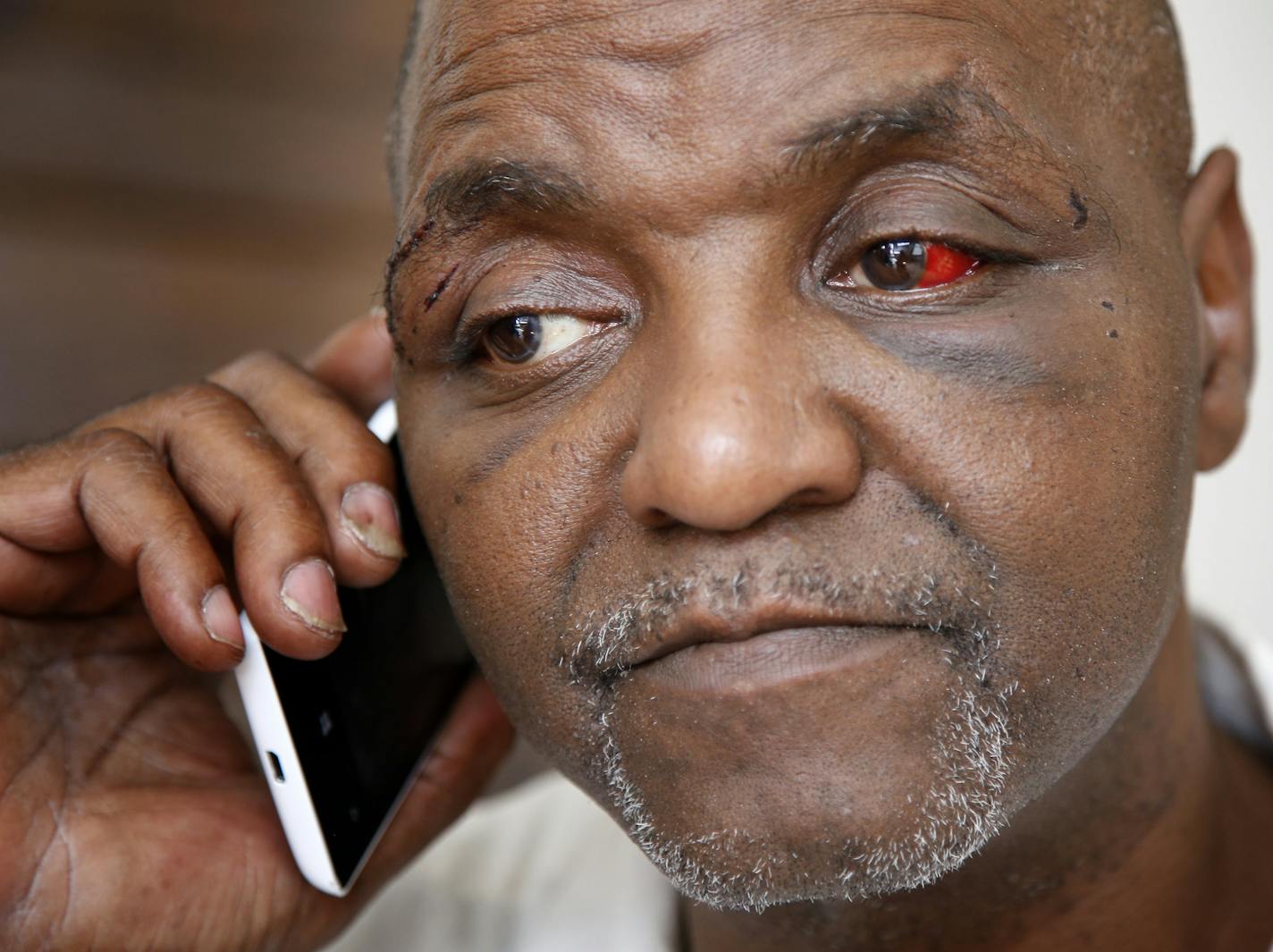 Al Flowers, of Minneapolis spoke on the phone. Flowers, was arrested after an altercation with police officers at his home early Saturday. His family and friends say that Flowers suffered injuries to his head and torso during the arrest. ] CARLOS GONZALEZ cgonzalez@startribune.com - July 28, 2014 , Minneapolis, Minn., Al Flowers, a Minneapolis activist who spoke out last week against increasing violence in north Minneapolis, was arrested after an altercation with police officers at his home earl