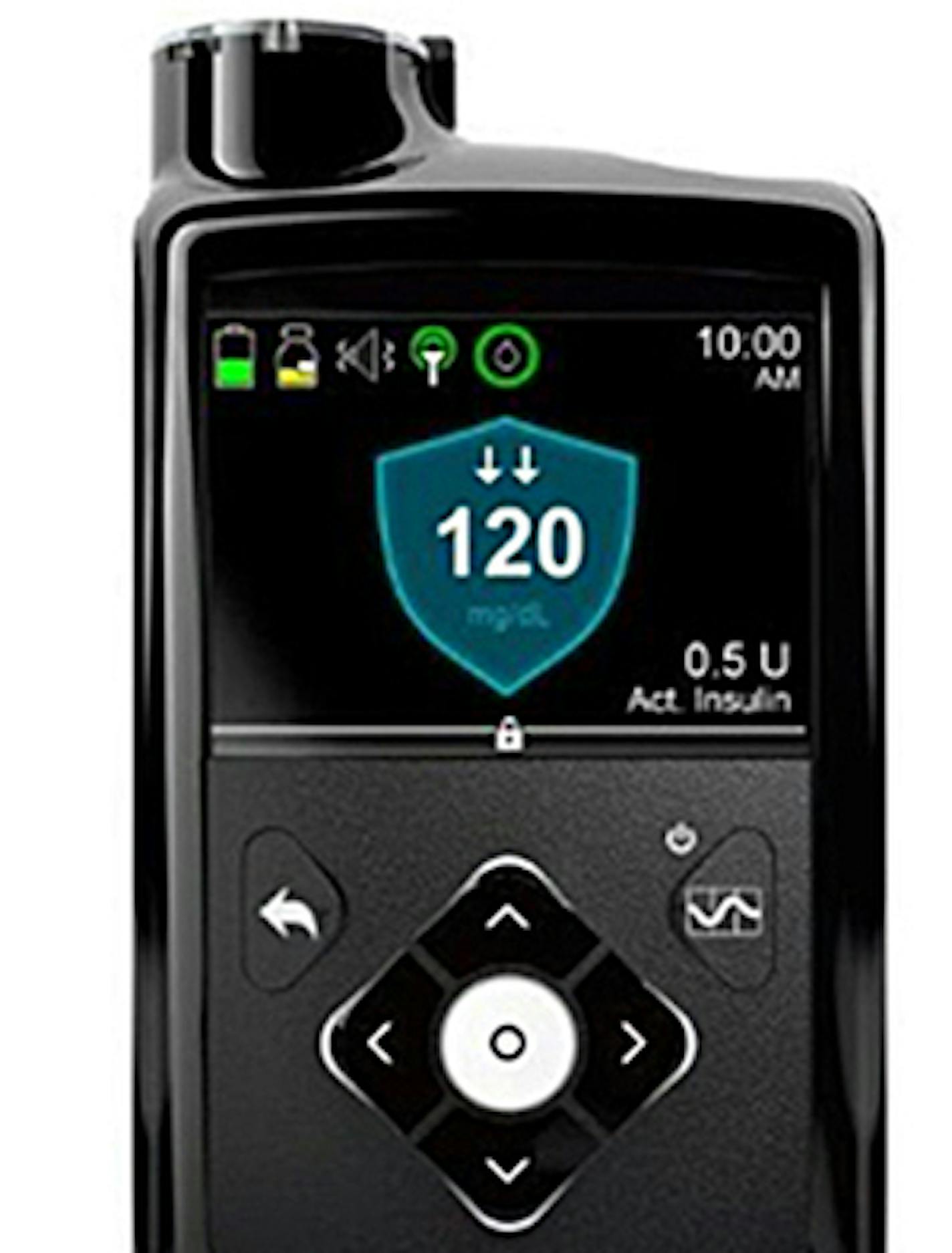 Medtronic's MiniMed 670G &#x201c;hybrid closed-loop&#x201d; system