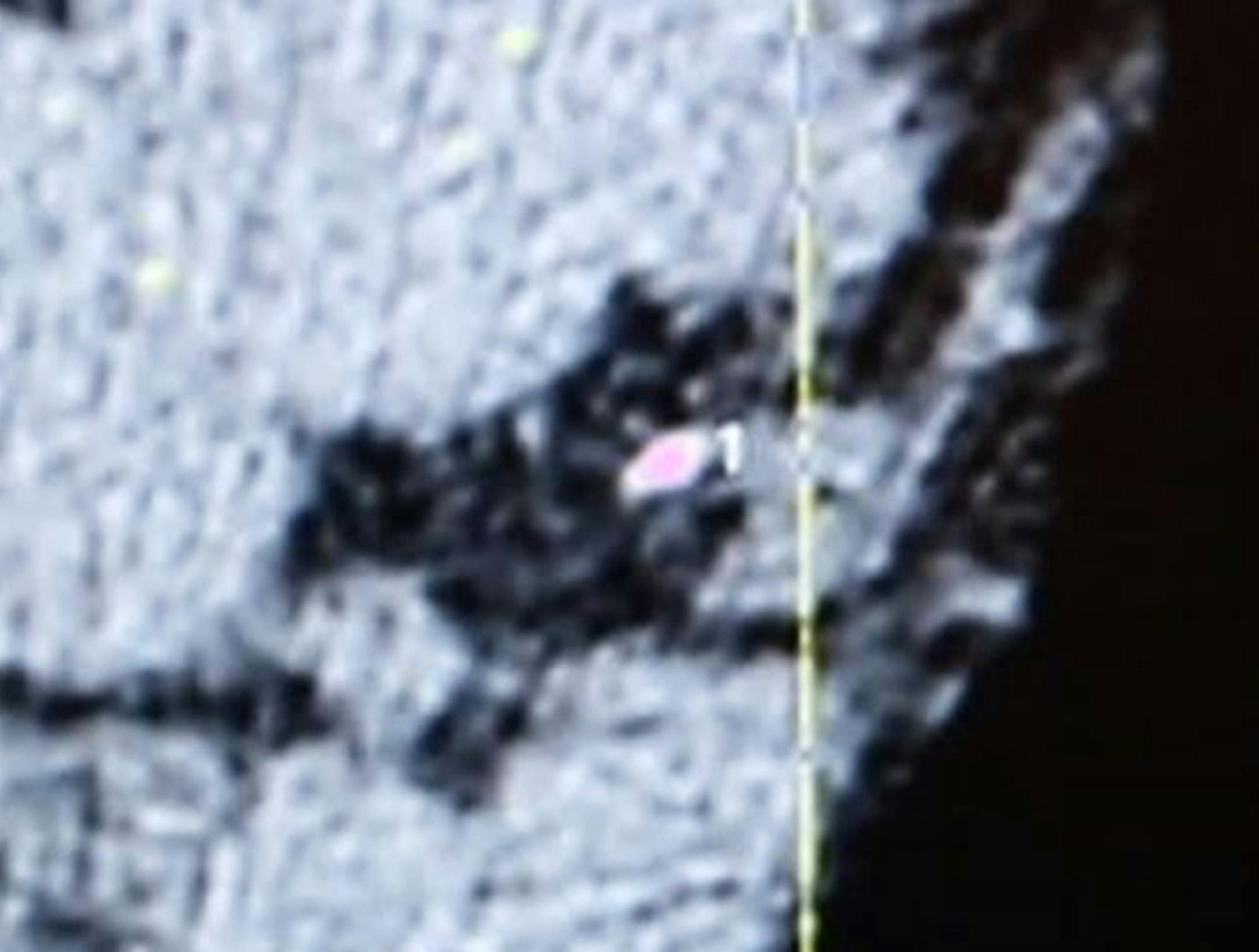 At Abbott Northwestern, reporter Jim Walsh underwent a CT scan to check for cardiovascular disease at HeartScan MN. Dr. Thomas Knickelbine of the Minnesota Heart Institute found a small calcium plaque deposit that could point to future troubles if changes in diet, exercise, and perhaps the use of a statin were not implemented.] rtsong-taatarii@startribune.com