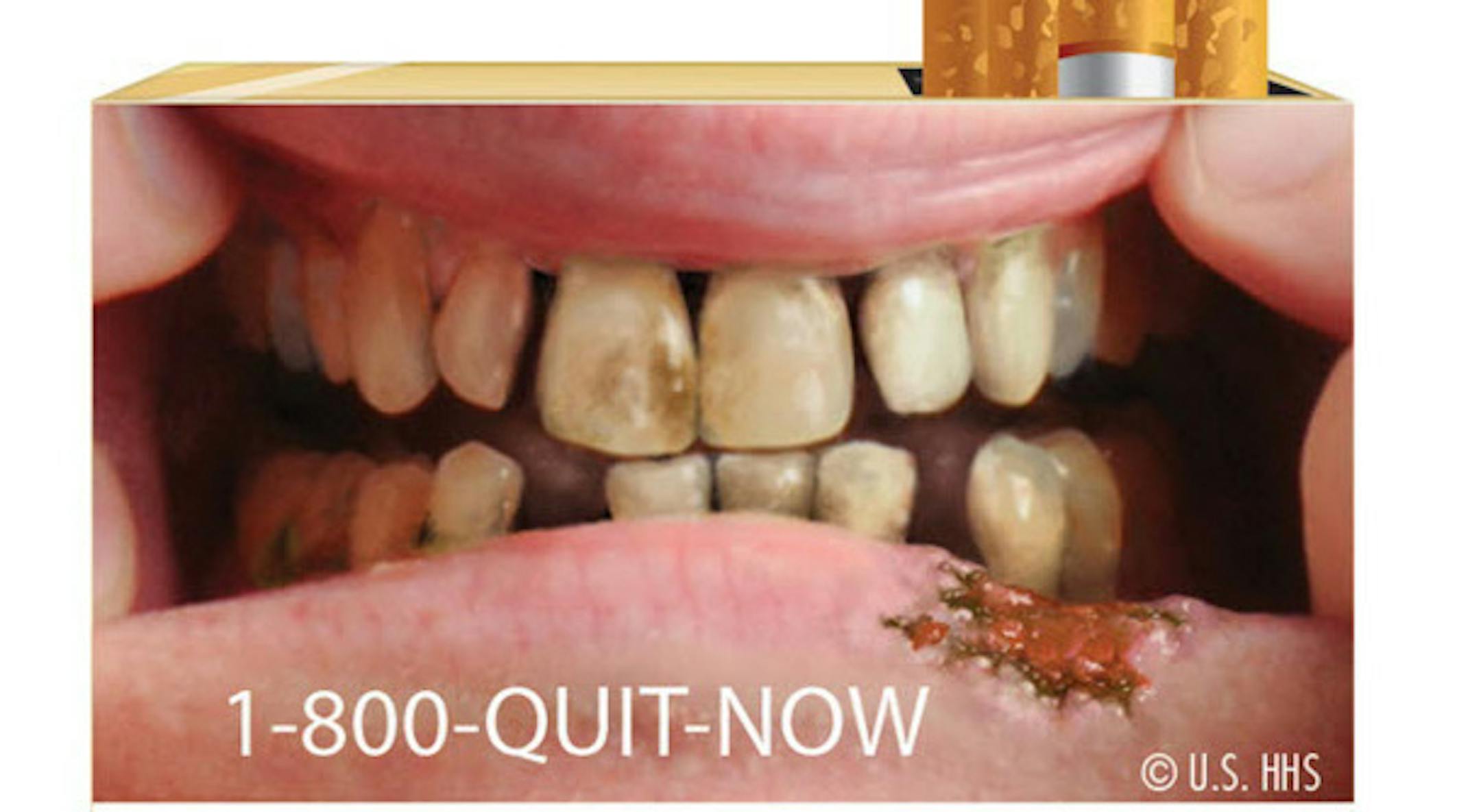 In the most significant change to U.S. cigarette packs in 25 years, the FDA's new warning labels depict in graphic detail the negative health effects of tobacco use.