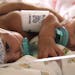 Conjoined twins Paisleigh and Paislyn Martinez, seen at 6 weeks, were separated in a nine-hour surgery at the University of Minnesota Masonic Children