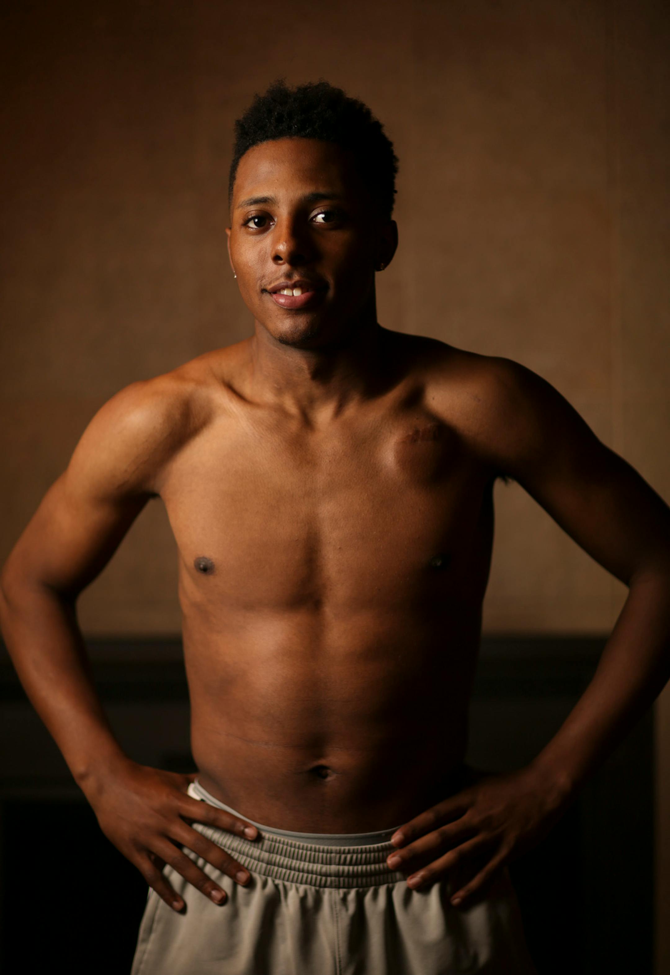 Jarvis Johnson at his family's Brooklyn Park home. ] JEFF WHEELER • jeff.wheeler@startribune.com Jarvis Johnson, the DeLaSalle player who is the state's top basketball recruit, should be dead. His heart stopped for 12 minutes at the beginning of a practice when he was an eighth grader. Now with a defibrillator implanted in his chest, he's committed to the University of Minnesota. He was photographed at his family's Brooklyn Park home Thursday evening, January 15, 2015.