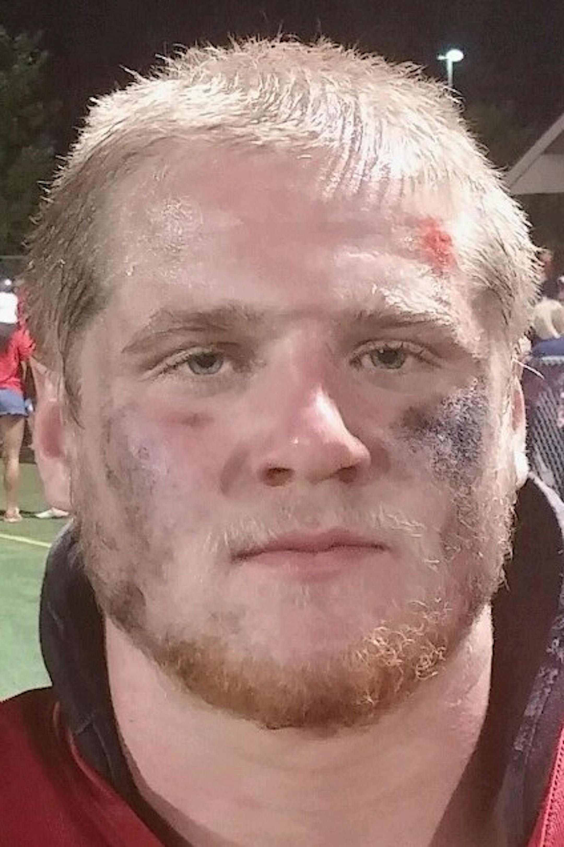 Braeden Fitzgerald, Benilde-St. Margaret's junior linebacker