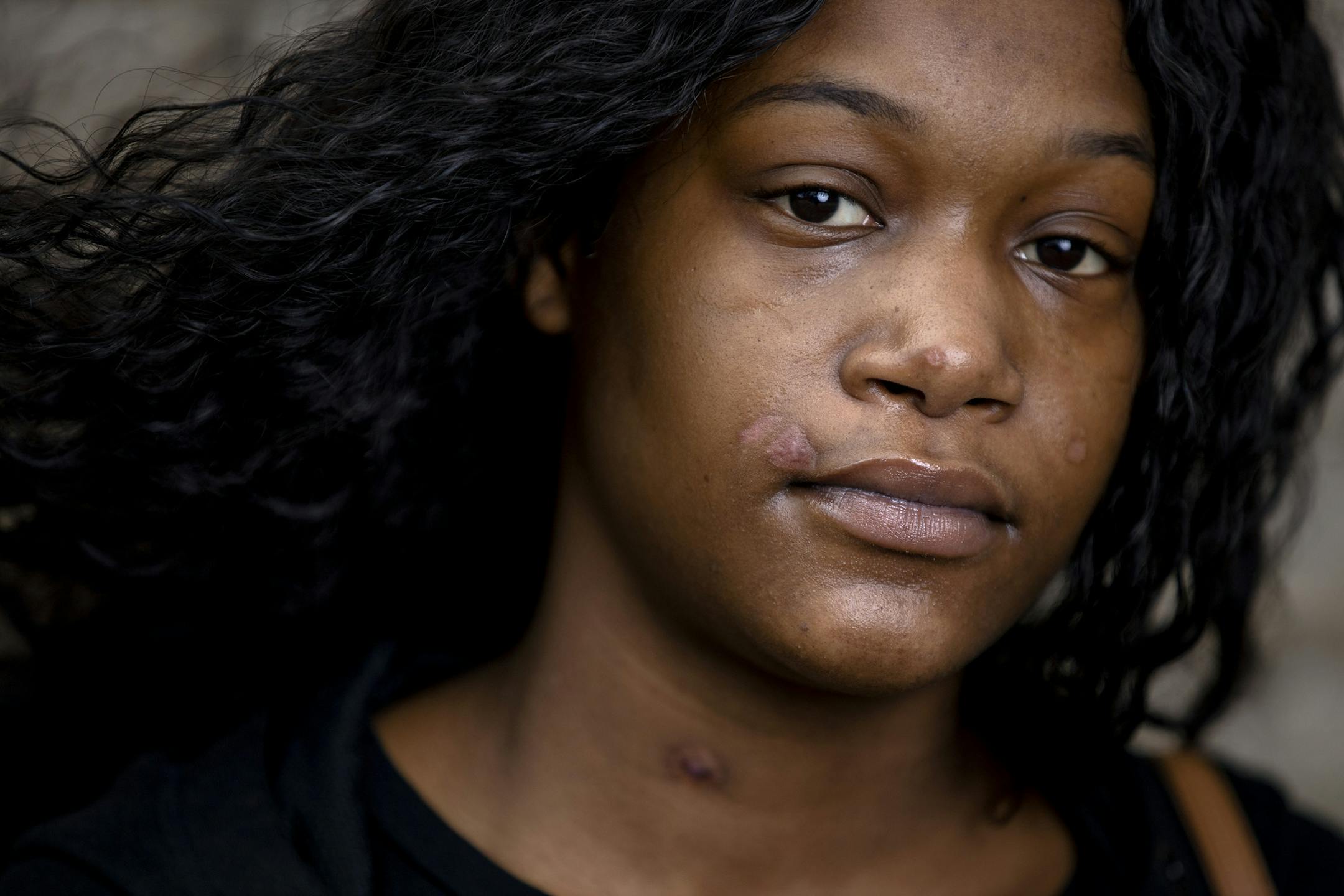 Na'Dasia Johnson, 20, is still picking up the pieces of her life, after an early-morning grease fire gutted her south Minneapolis apartment. ] CARLOS GONZALEZ • cgonzalez@startribune.com – Minneapolis, MN – April 9, 2020, Na'Dasia Johnson, 20, is still picking up the pieces of her life, after an early-morning grease fire gutted her south Minneapolis apartment.