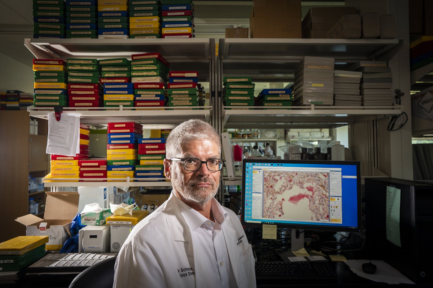 Dr. Timothy Schacker, a professor of medicine in the division of Infectious Diseases and International Medicine at the University of Minnesota, posed for a photo inside his lab. On his computer screen is a slide of a human lung tissue infected by SARS-CoV-2. ] LEILA NAVIDI • leila.navidi@startribune.com BACKGROUND INFORMATION: Dr. Timothy Schacker, a professor of medicine in the division of Infectious Diseases and International Medicine at the University of Minnesota, posed for a photo inside hi