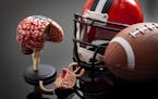 Brain damage and sports injury concept with damaged brain model, american football helmet and a ball, illustrating CTE (Chronic traumatic encephalopat