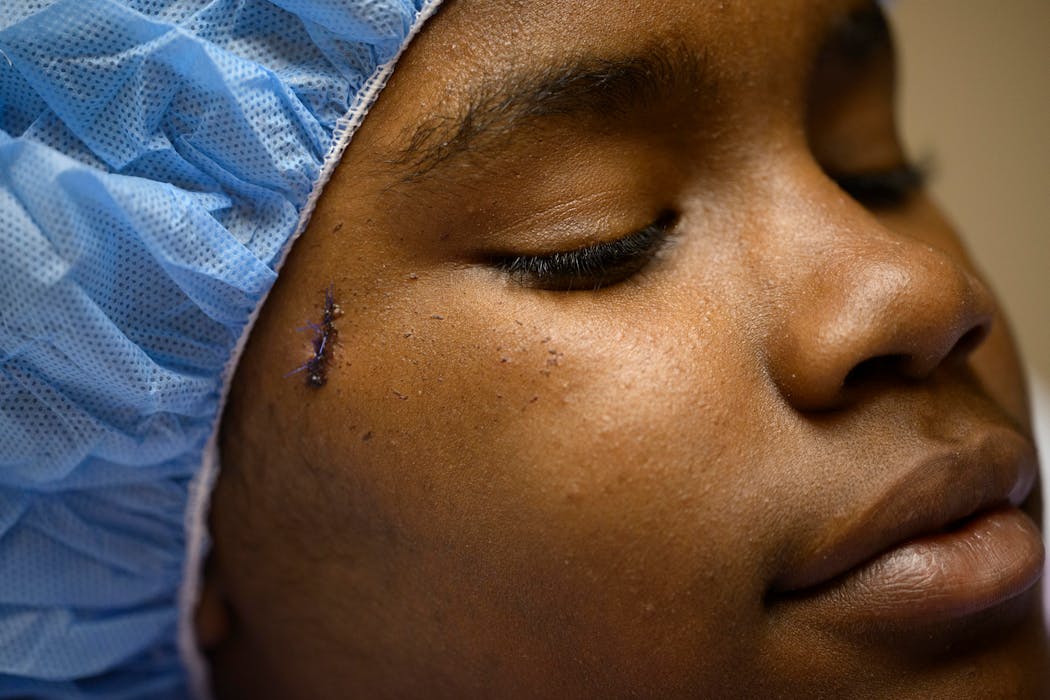 La’neria Wilson waited for surgery Wednesday, just two days before her 12th birthday, at HCMC in Minneapolis. Wilson was struck by gunfire beneath her right eye inside her bedroom minutes into the new year.
