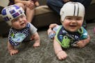 Nolan and Lincoln Potts wore their custom made "CranioCaps," that were made with the help of 3-D printed molds of the boys' heads, at Gillette Childre