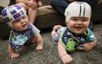 Nolan and Lincoln Potts wore their custom made "CranioCaps," that were made with the help of 3-D printed molds of the boys' heads, at Gillette Childre