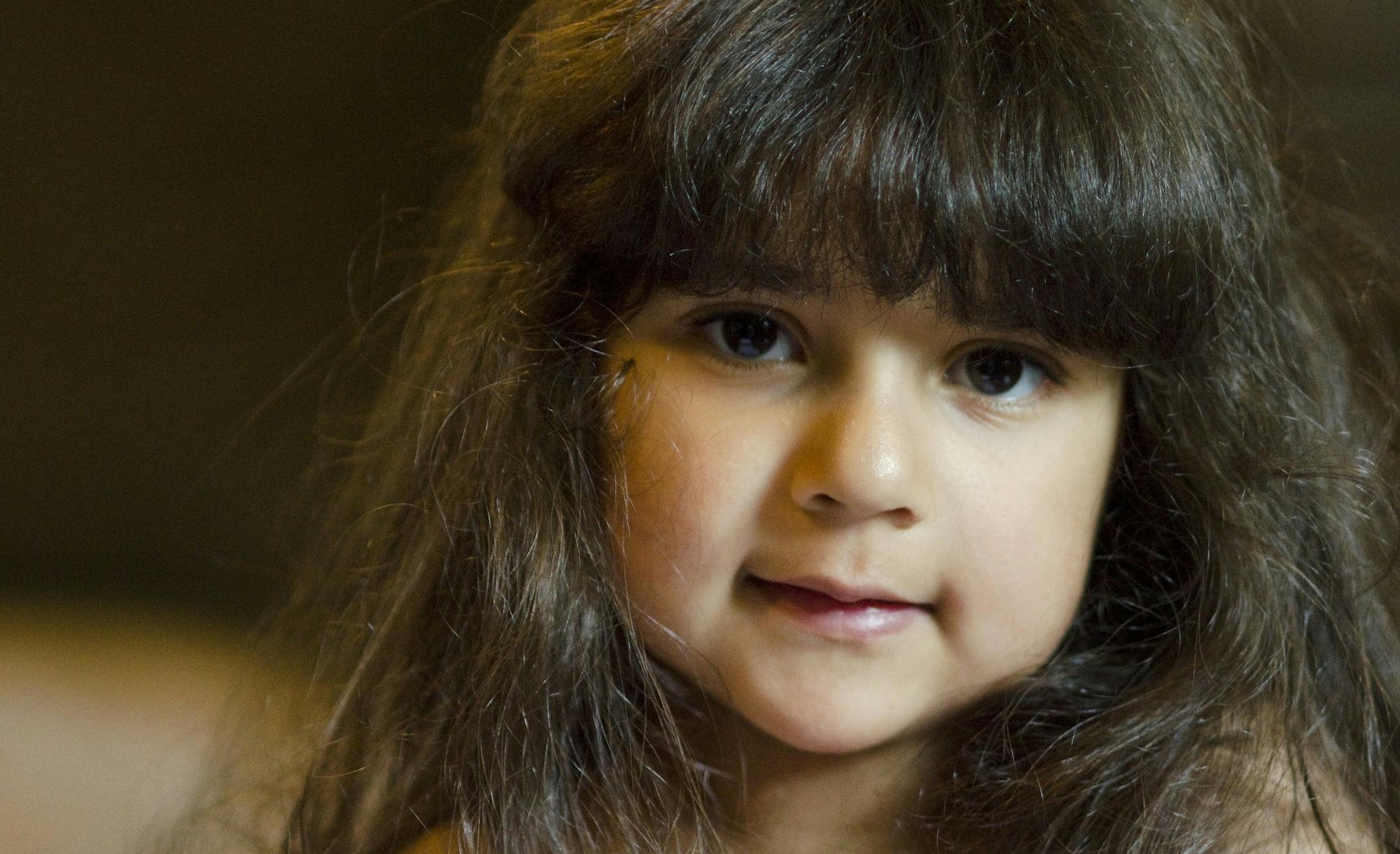 Angela Irizarry, 5, of Lewisburg, Pa., is thriving after receiving a lab-grown blood vessel two years ago.