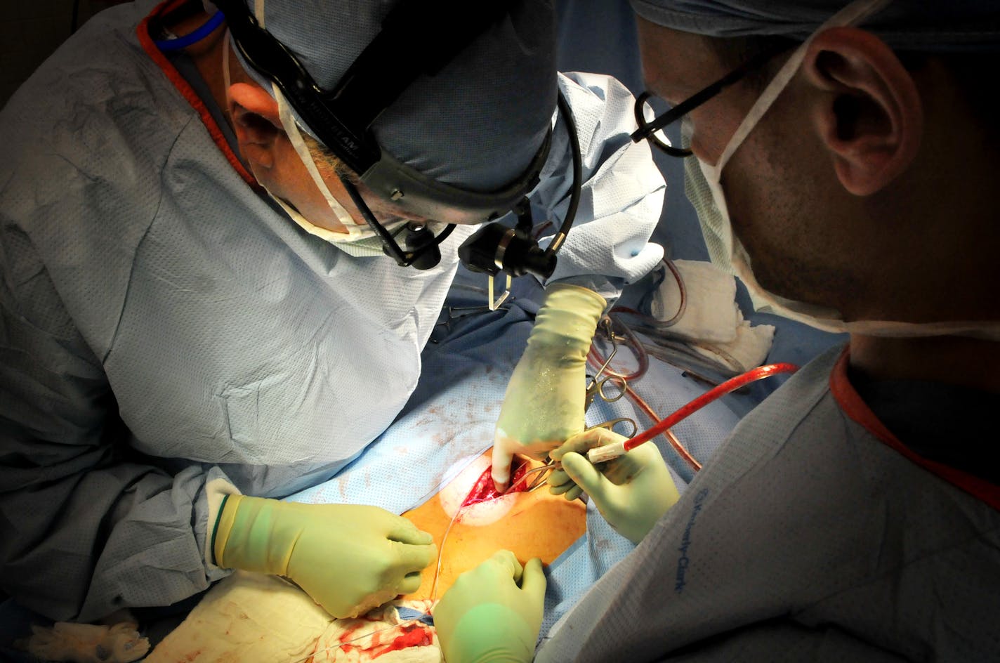 Dr. Charles Burton, left, performed laminectomy spine surgery with replacement of a spinal neurostimulator on Ron Tryor at Saint Joseph's Hospital in St. Paul. Assisting, right is Dr. David Frenz.