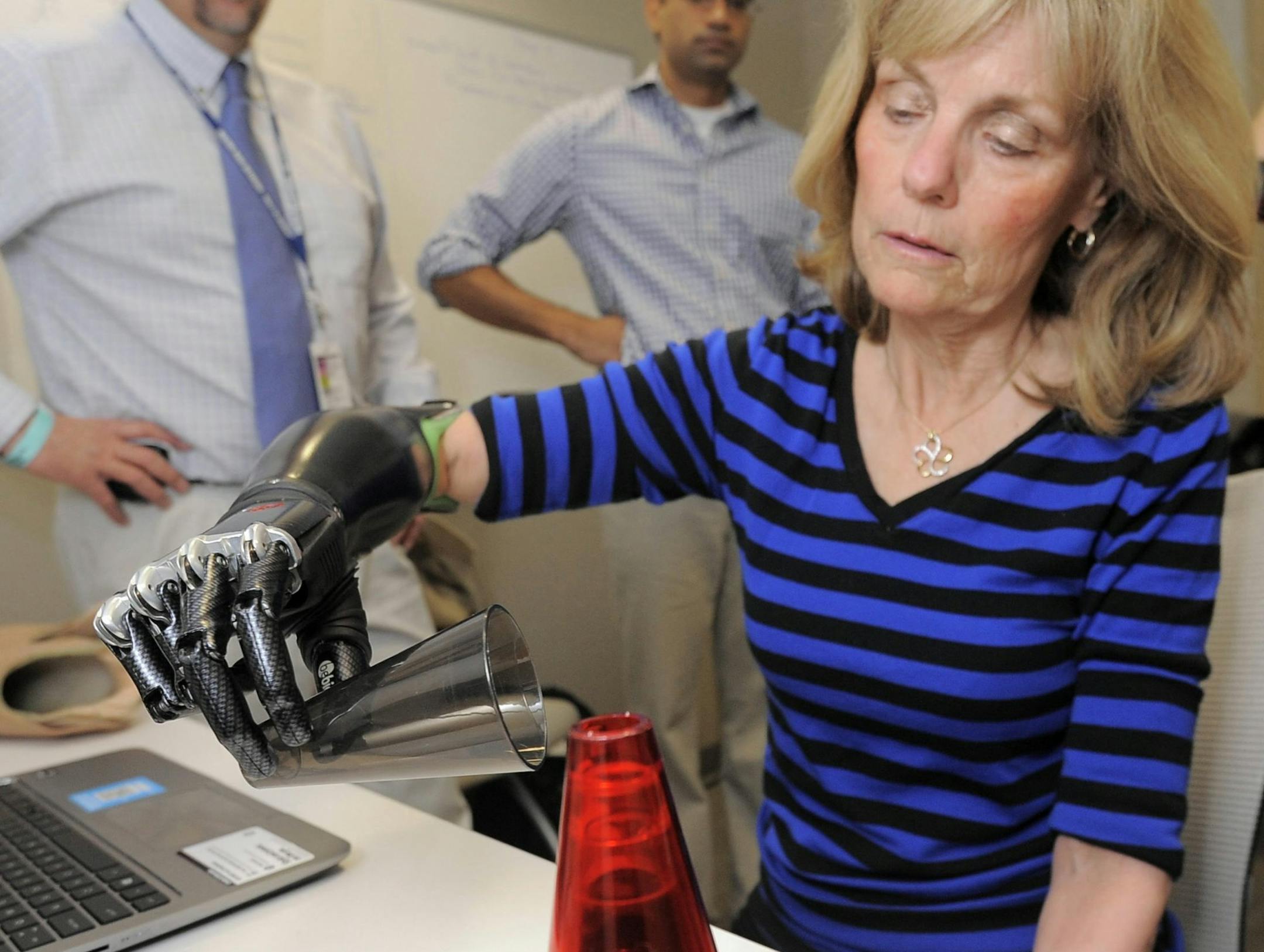 Quadruple amputee Anne Mekalian learns to use a thought-controlled prosthetic hand in Baltimore on Nov. 22, 2013. (Kim Hairston/Baltimore Sun/MCT)