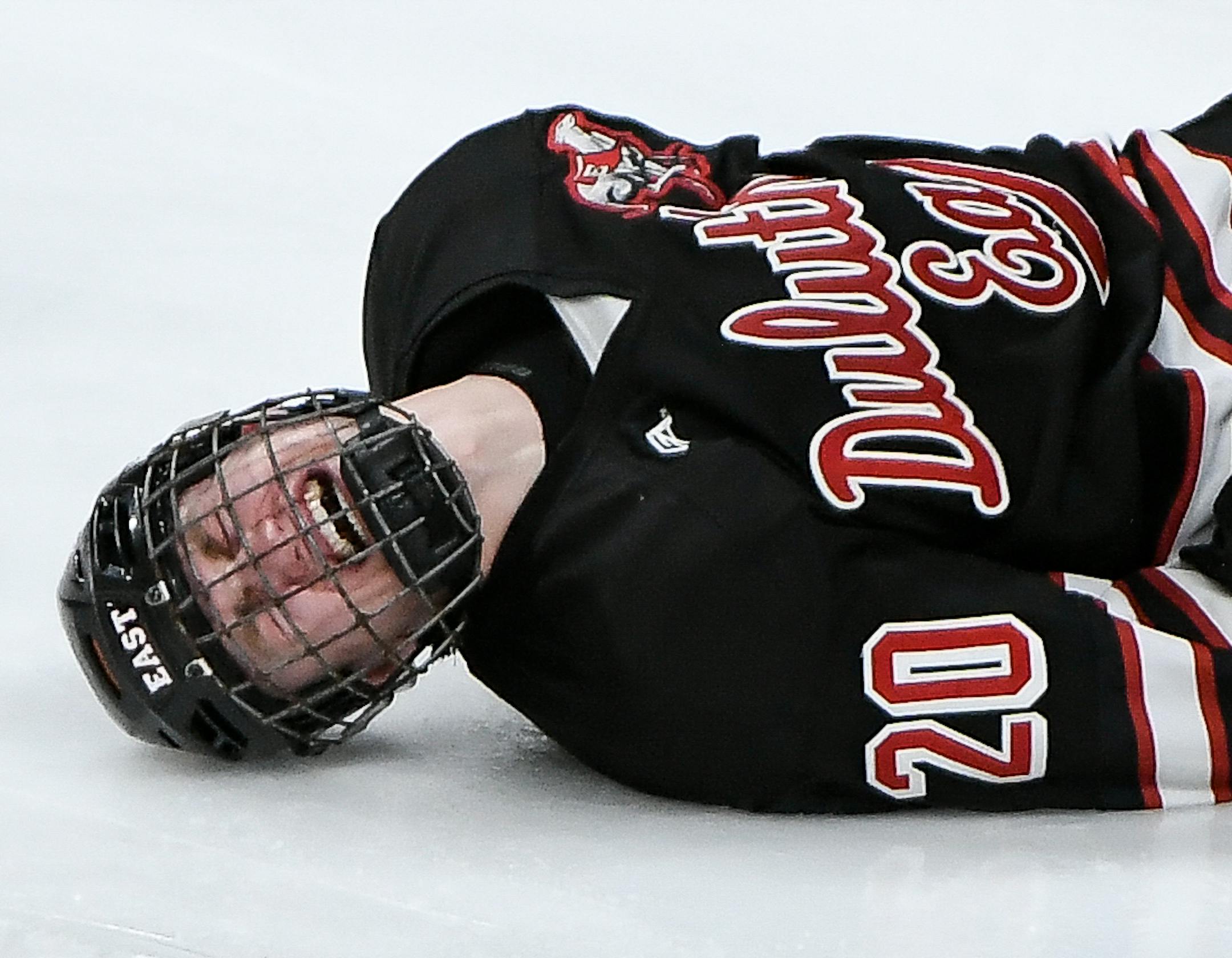 Duluth East defenseman Frederick Hunter Paine (20) was helped off the ice after being pushed into his own team's goal by Minnetonka forward Luke Loheit (8), resulting in a penalty for Loheit in the second period. ] AARON LAVINSKY &#xef; aaron.lavinsky@startribune.com Minnetonka played Duluth East in the Class 2A boys' hockey championship game on Saturday, March 10, 2018 at Xcel Energy Center in St. Paul, Minn.