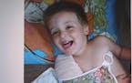 Public outrage over the abuse of 4-year-old Eric Dean, photographed here with a broken arm, triggered far-reaching reforms to Minnesota's child protec