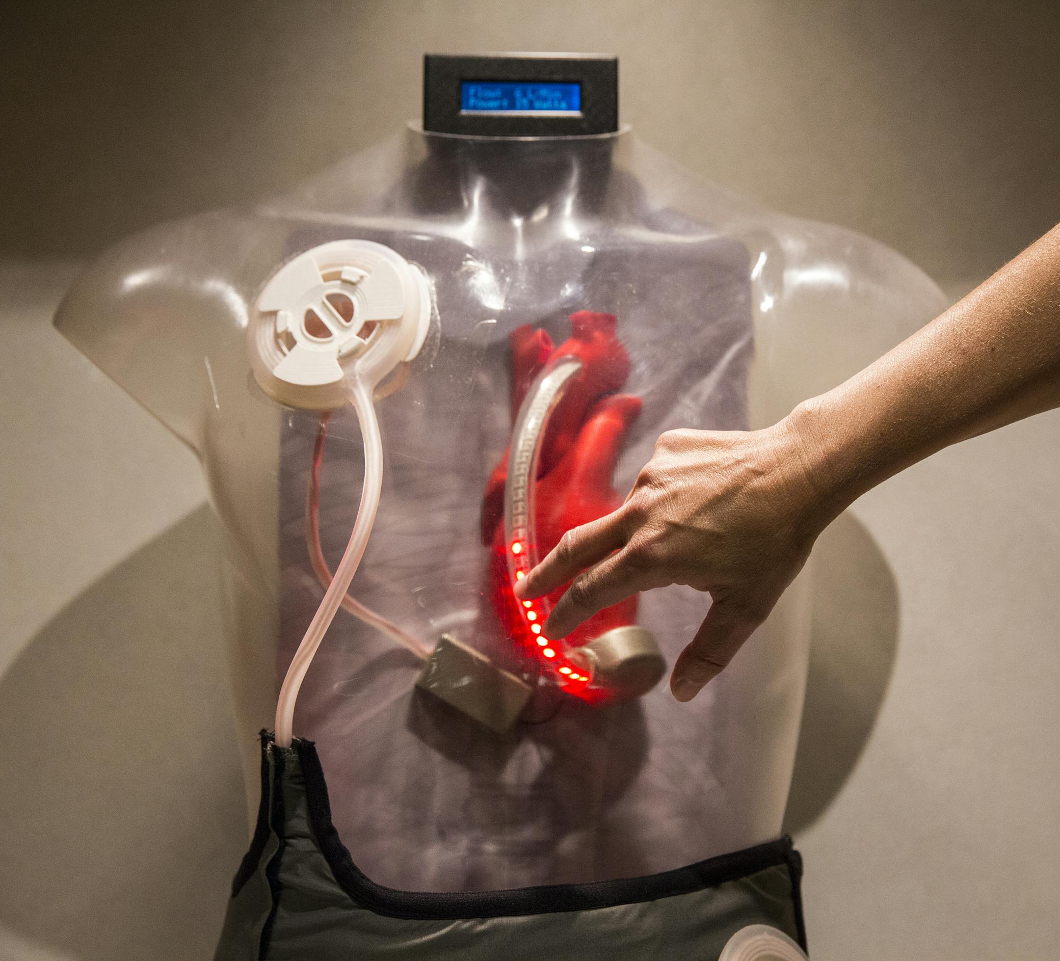 Lori Lucke, a systems engineer fellow with Minnetronix, explains the TETS (Transcutaneous Energy Transmission System), a wireless power transfer system used to run an LVAT (Left Ventricular Assist Device), or heart pump, on display at Minnetronix in St. Paul on Wednesday, August 5, 2015. ] LEILA NAVIDI leila.navidi@startribune.com / BACKGROUND INFORMATION: Minnetronix is marketing a new technology that allows the batteries in implantable medical devices to be recharged wirelessly. The technology