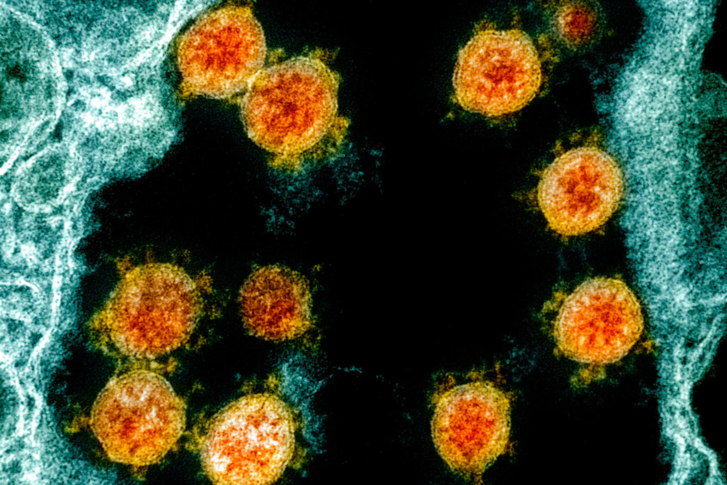 Minnesota COVID-19 rate up again after July 4 holiday
