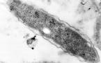 This is a magnified image of the Legionnaires bacterium made from an electron microscope.