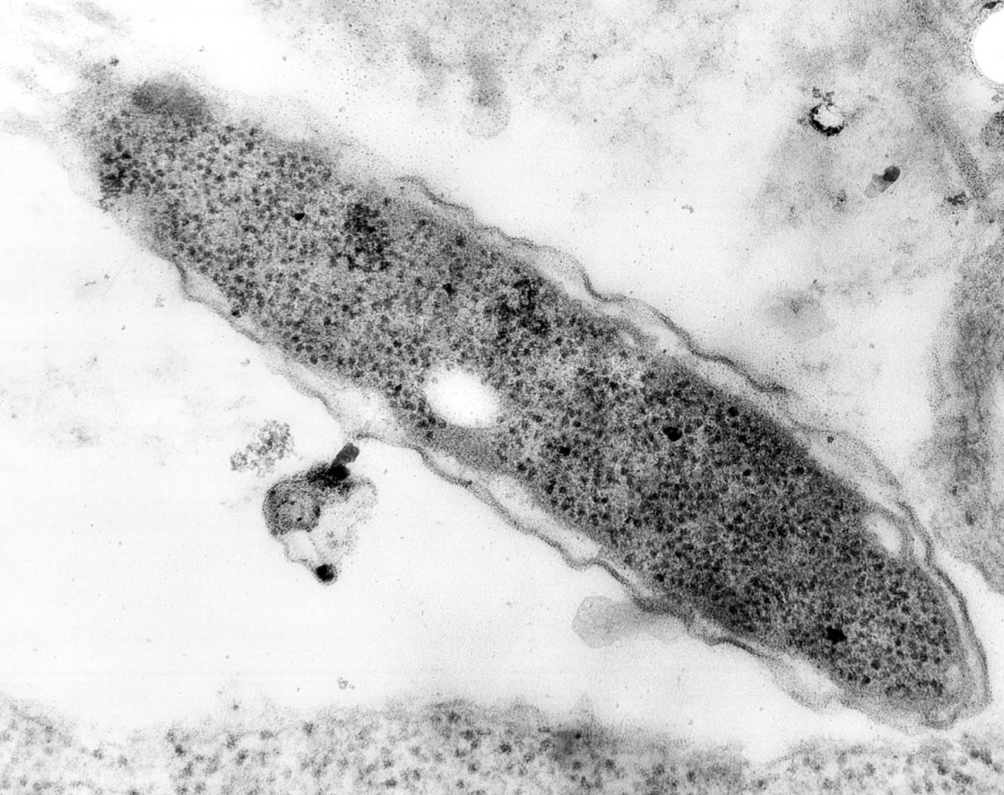 This is a magnified image of the Legionnaires bacterium made from an electron microscope.