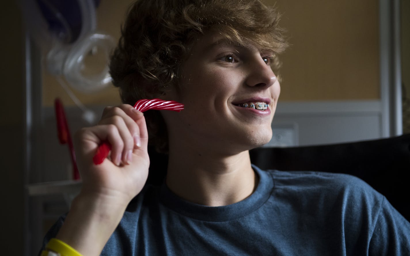 Daniel Fleigle ate Twizzlers in his hospital room with his friends after a press conference held at the hospital on Monday. ] Isaac Hale &#x2022; isaac.hale@startribune.com Daniel Fleigle and his family held a press conference Monday, June 27, 2016, at the HCMC Emergency Department in downtown Minneapolis, MN. Fleigle was climbing atop a long-closed Mississippi River Bridge earlier in June when he was shocked by an electrical wire and fell about 30 feet.